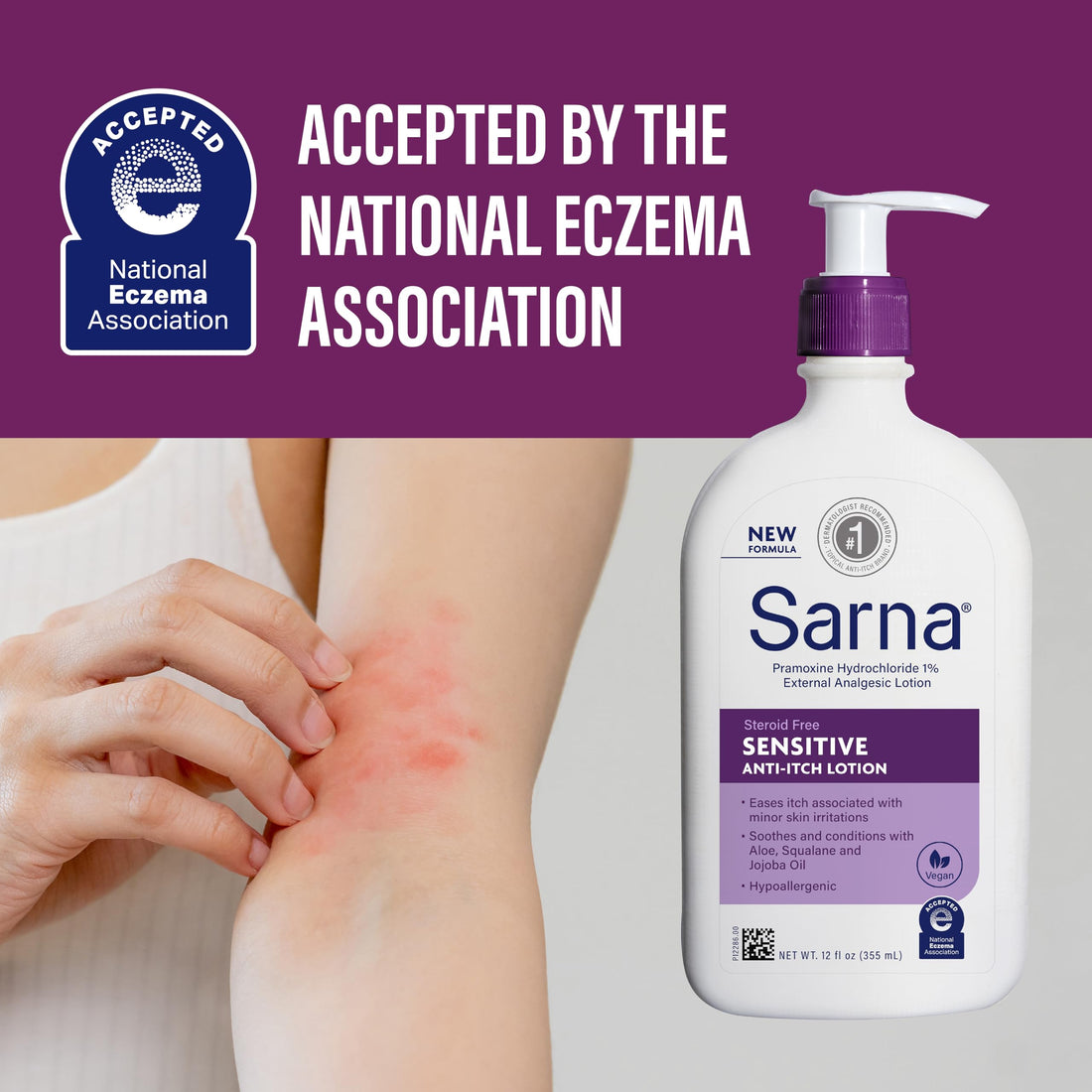Sarna Sensitive Anti-Itch Lotion, Steroid-Free, Fragrance-Free, Vegan, Hypoallergenic, National Eczema Association Accepted, 1% Pramoxine Hydrochloride, 12 oz