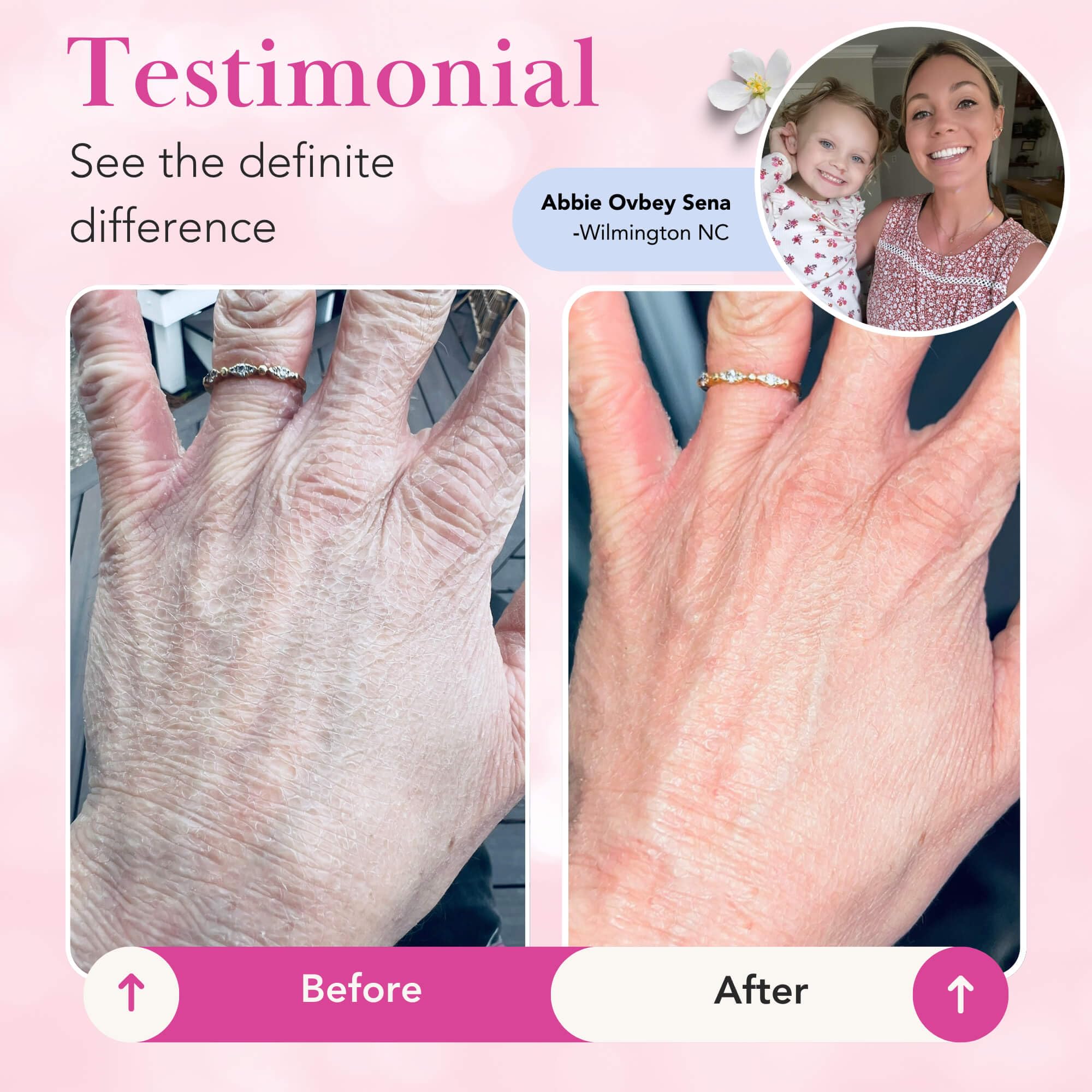 Theraplex Clear Lotion Spray 8 oz