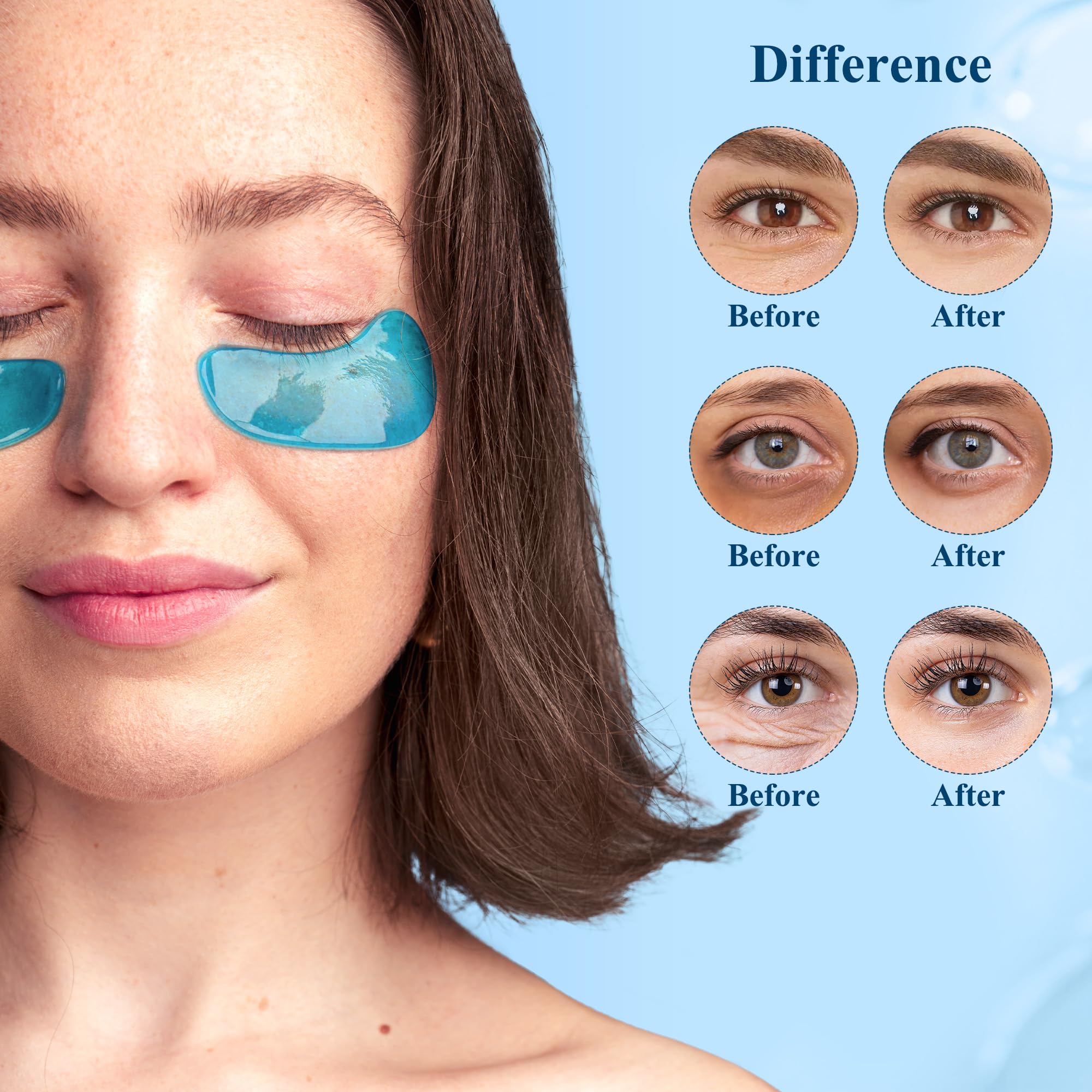 Under Eye Patches (30 Pairs), Under Eye Mask for Puffy Eyes and Dark Circles, Eye Masks with Collagen, Relieves Pressure and Reduces Wrinkles, Revitalises and Refreshes Your Skin, Hyaluronic Acid
