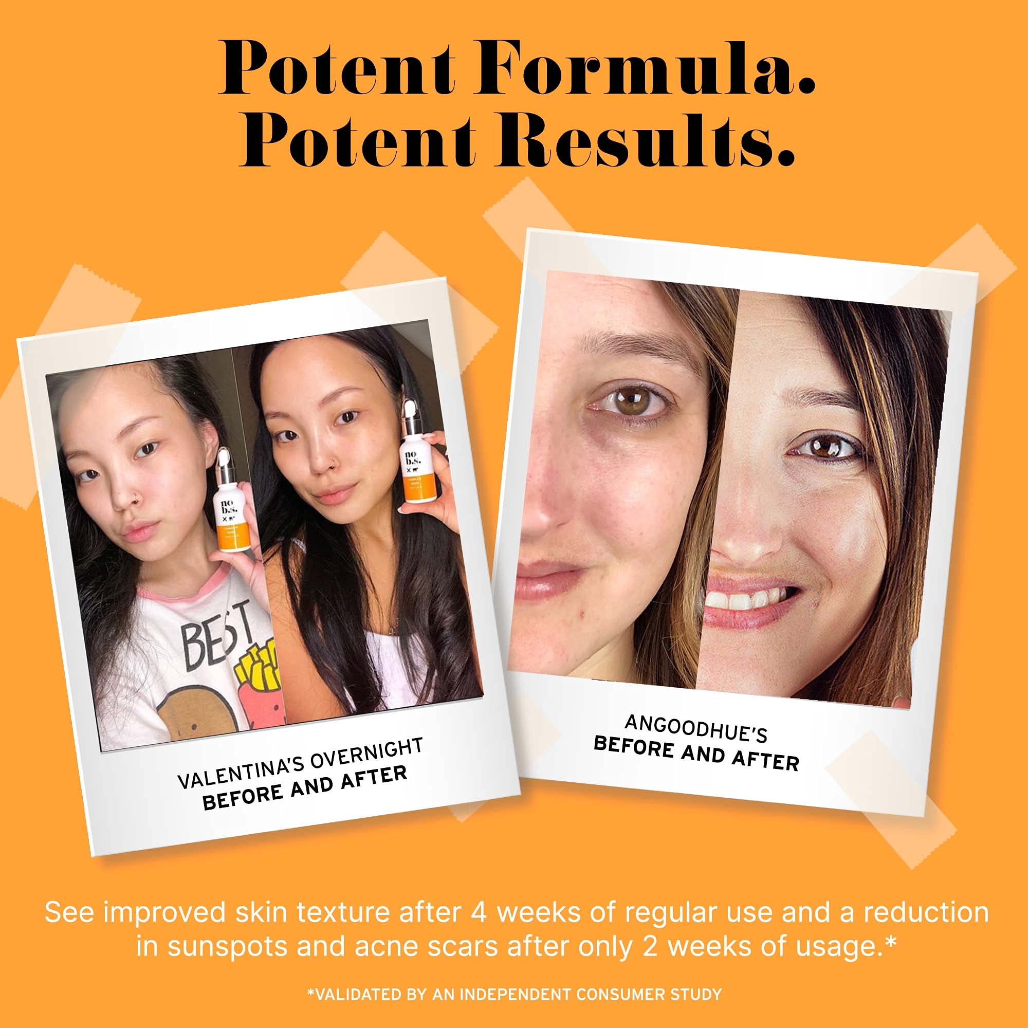 No B.S. Vitamin C Serum and Retinol Cream Duo - Wrinkle Creams That Really Work and Dark.