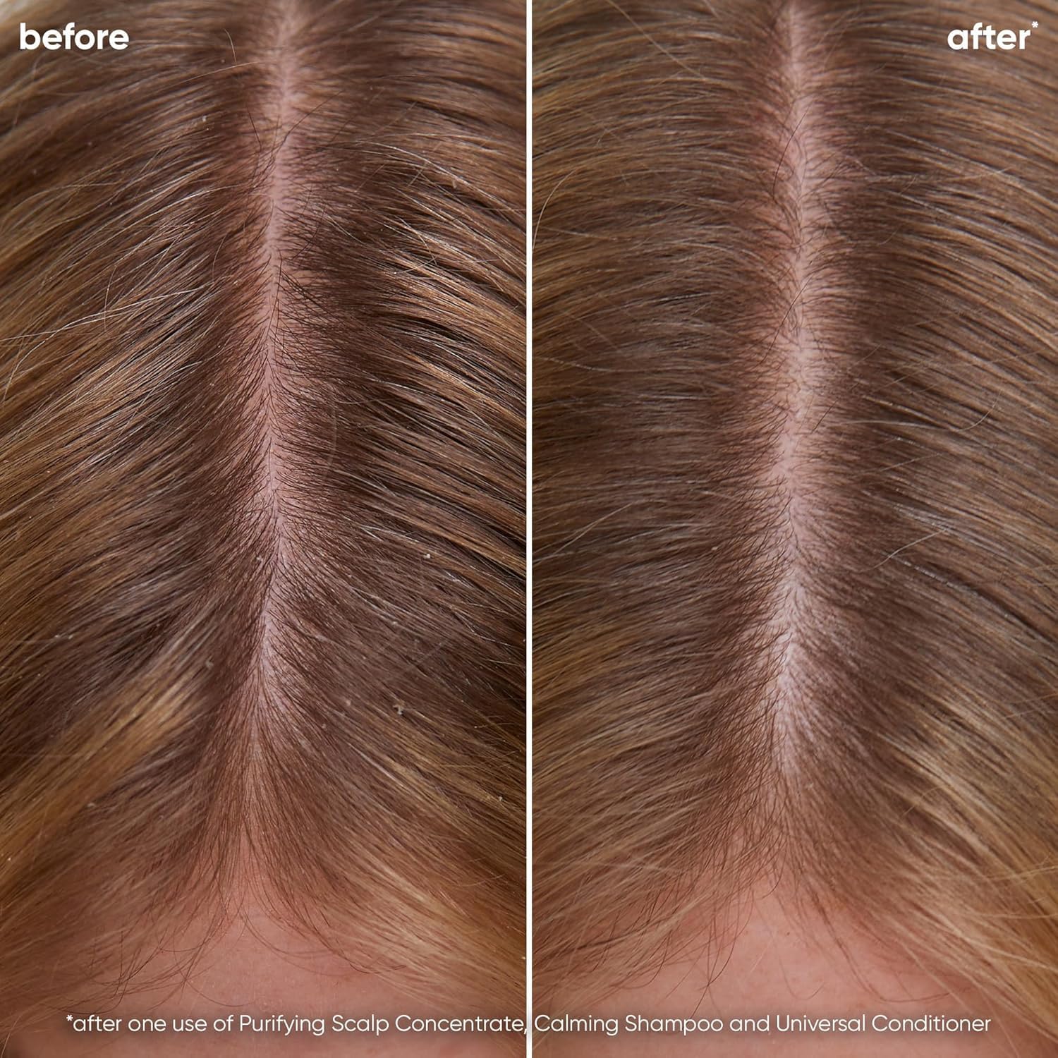 Biolage Scalp Sync Calming Shampoo - Gently Cleanses Dry & Sensitive Scalps, Hydrates & Soothes, Fermented Tea Blend & Glycolic Acid, Vegan & Paraben-Free, 13.5 Fl Oz, Packaging May Vary