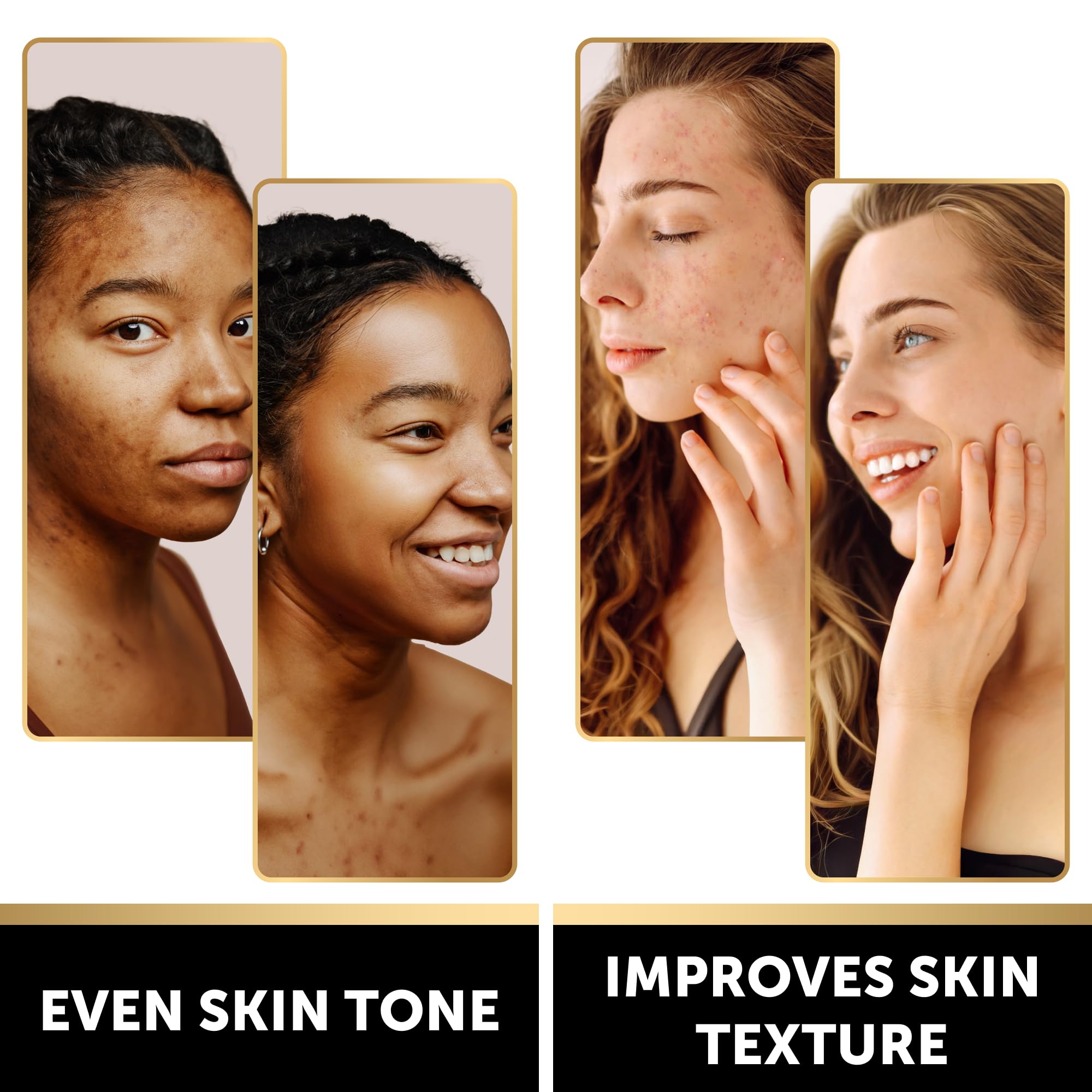 VALITIC Kojic Acid Soap Bars - Turmeric, Snail Mucin, Charcoal and Lemon - 4 Assorted Dark Spot Remover Soaps with Hyaluronic Acid, Vitamin C, Vitamin E and Shea Butter