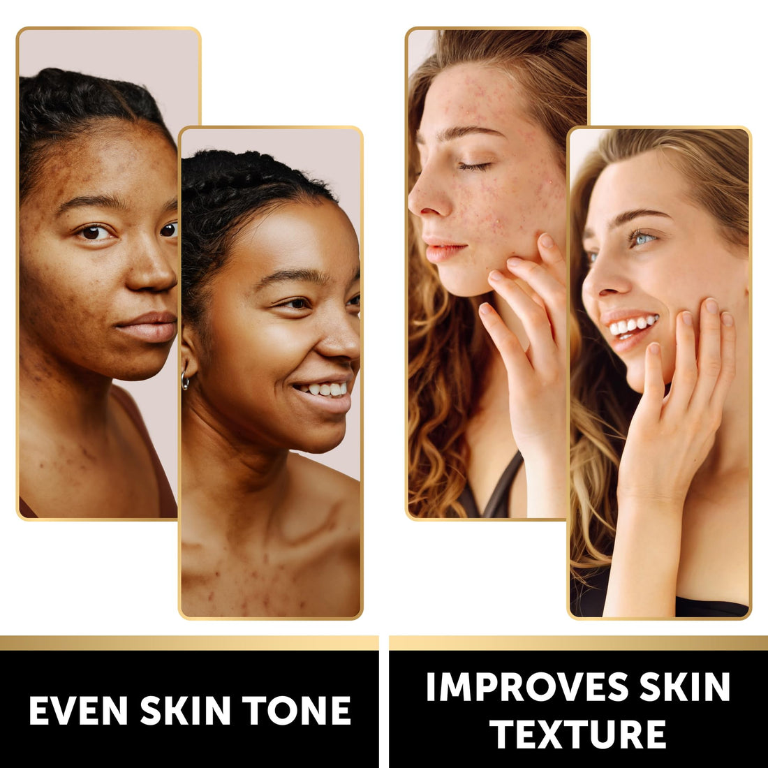 VALITIC Kojic Acid Soap Bars - Turmeric, Snail Mucin, Charcoal and Lemon - 4 Assorted Dark Spot Remover Soaps with Hyaluronic Acid, Vitamin C, Vitamin E and Shea Butter