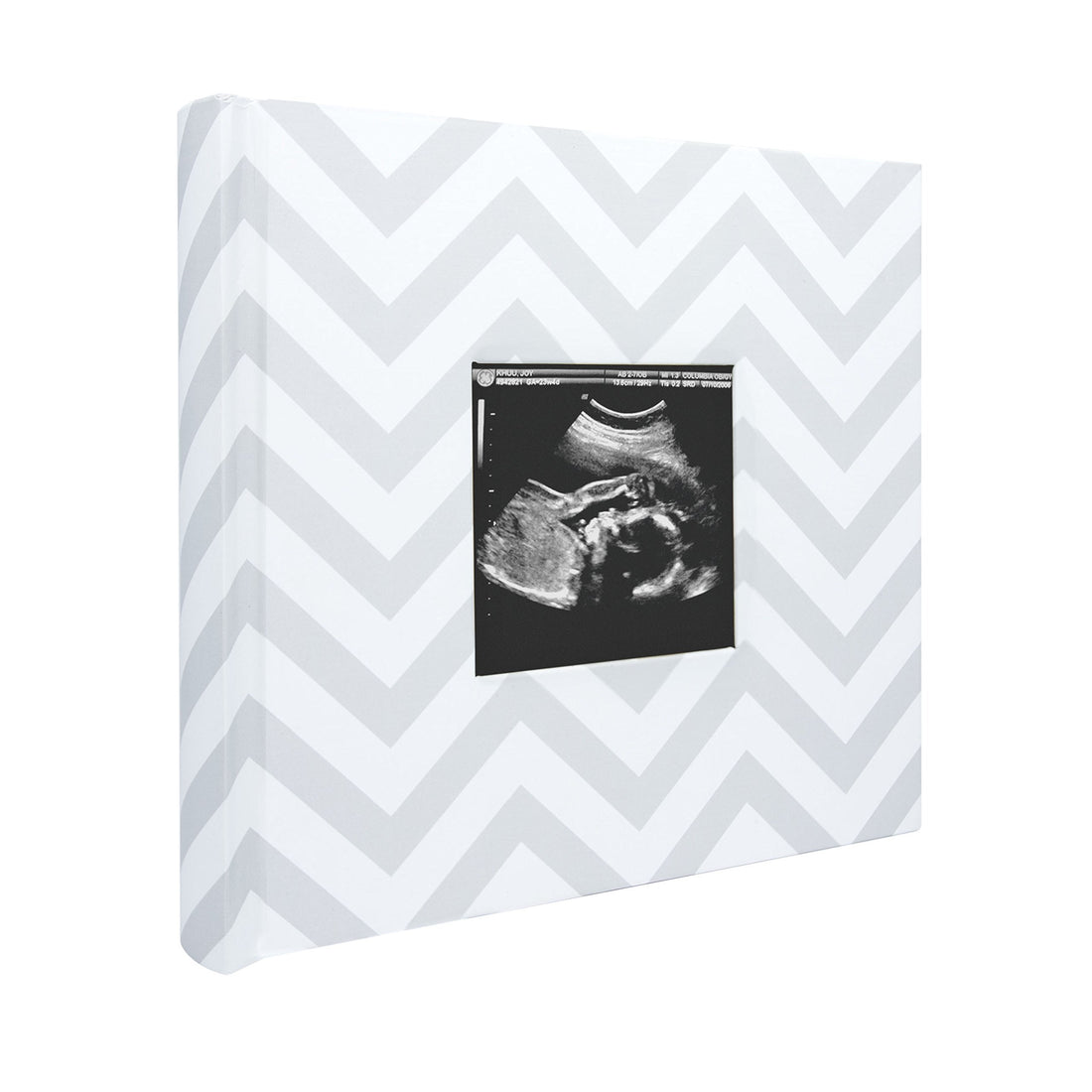 Pearhead Baby Newborn Photo Album, Baby Girl Memory Keepsake Book, Modern Newborn Milestone Book, Gift For New And Expecting Parents, Pink Chevron 1 Count (Pack of 1)