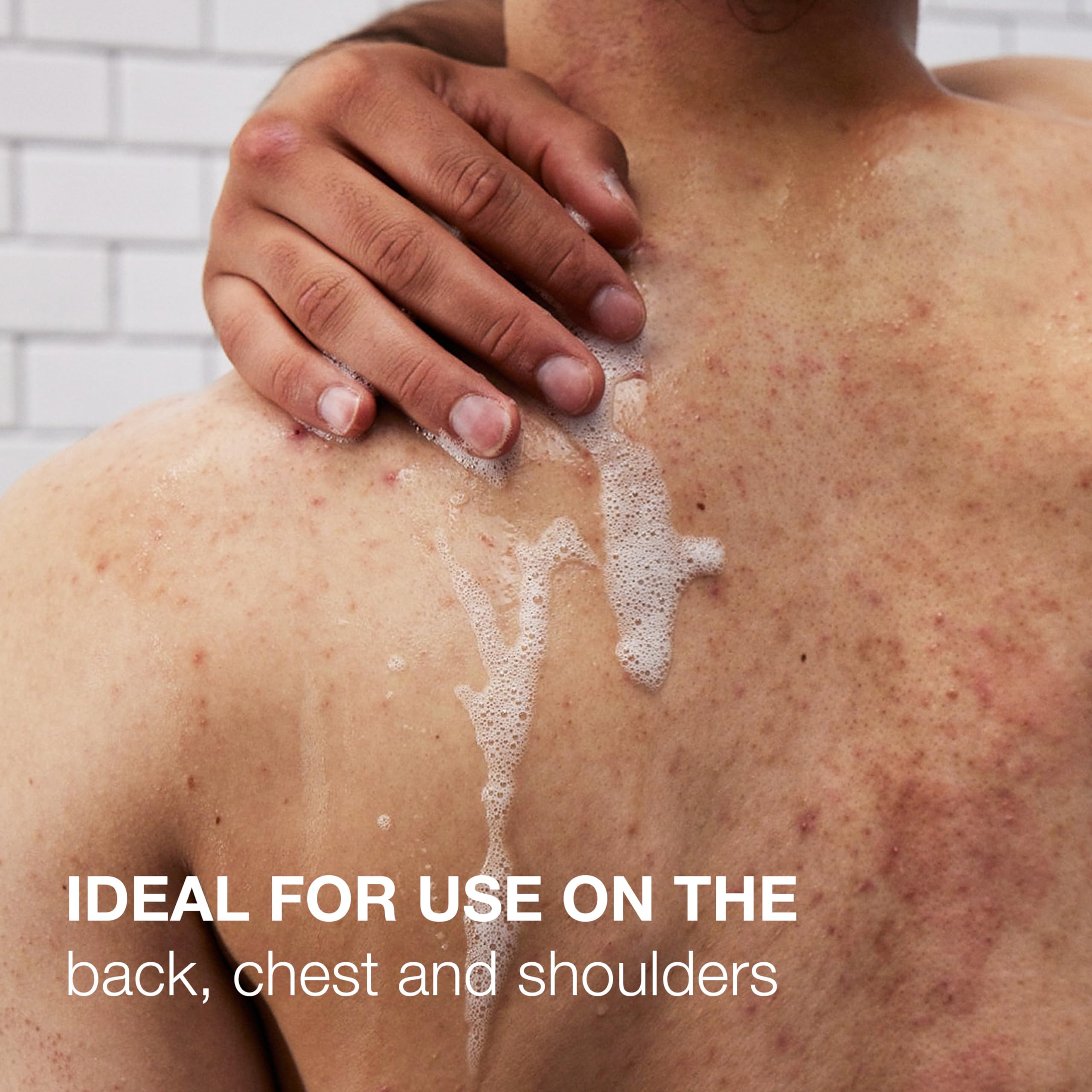 Neutrogena Stubborn Body Acne Cleanser & Exfoliator with Salicylic Acid & PHA for Acne-Prone Skin, Acne Treatment Gently Exfoliates & Helps Prevent Breakouts, Fragrance-Free, 8.5 fl. oz