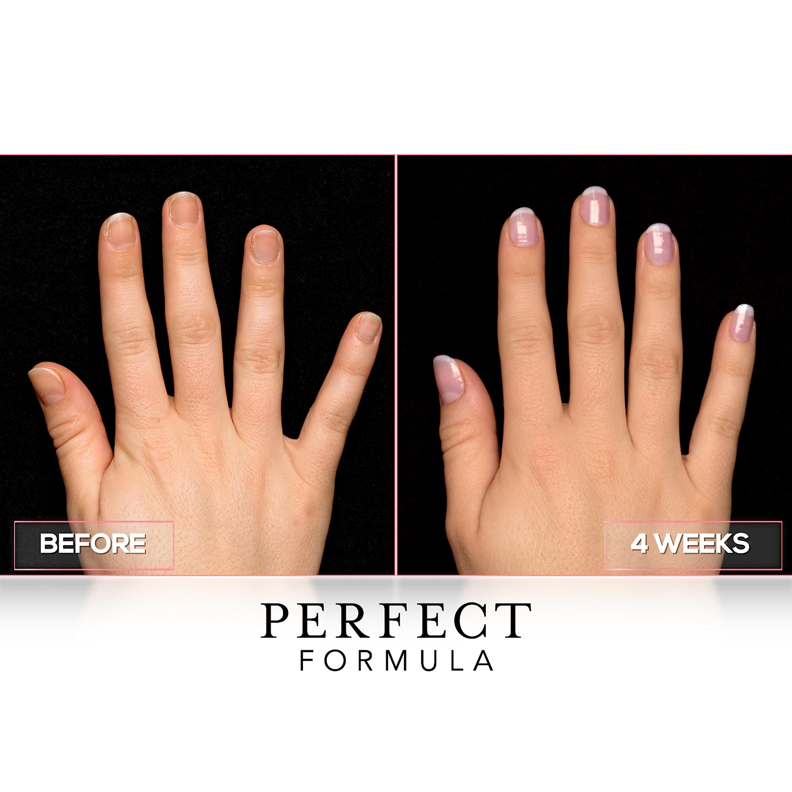 Perfect Formula Gel Coat Manicure Set