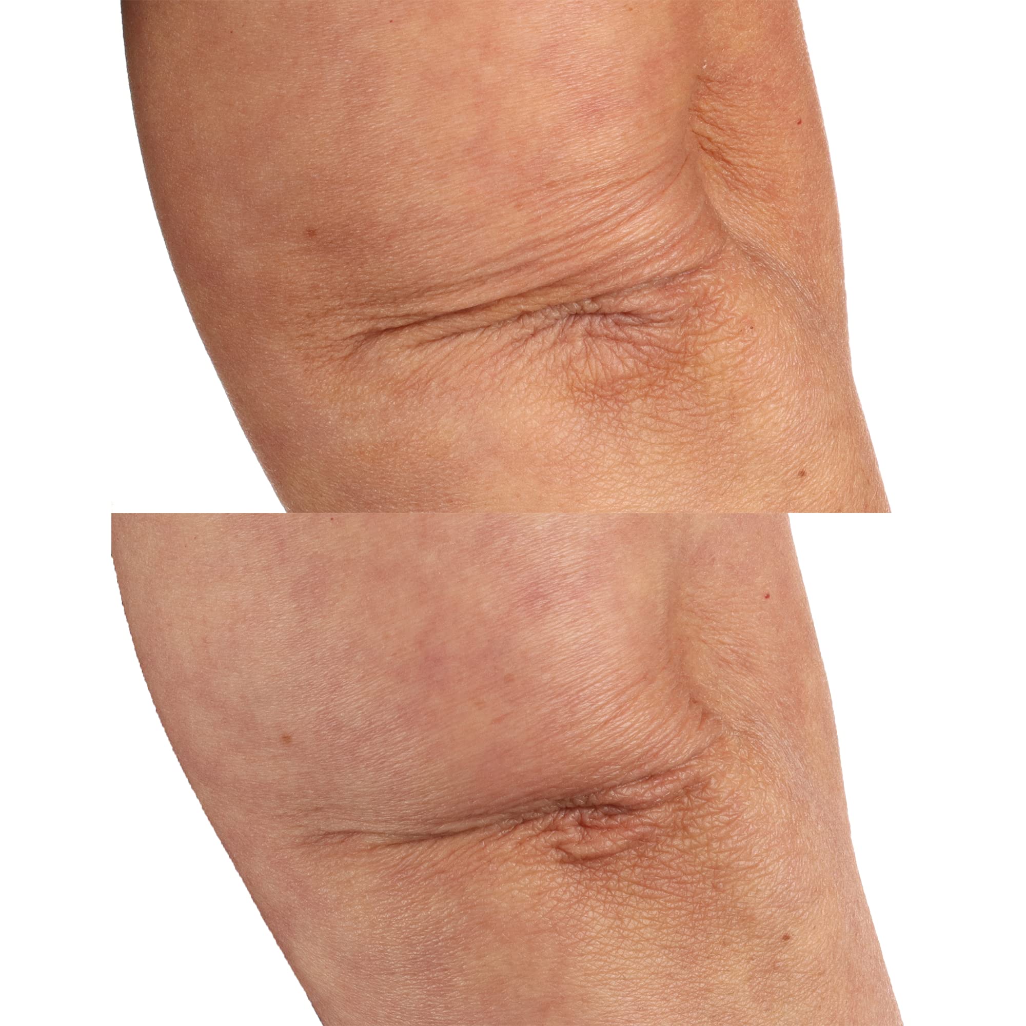 Perricone MD Essential Fx Acyl-Glutathione Chia Body Oil, 4 fl. oz.