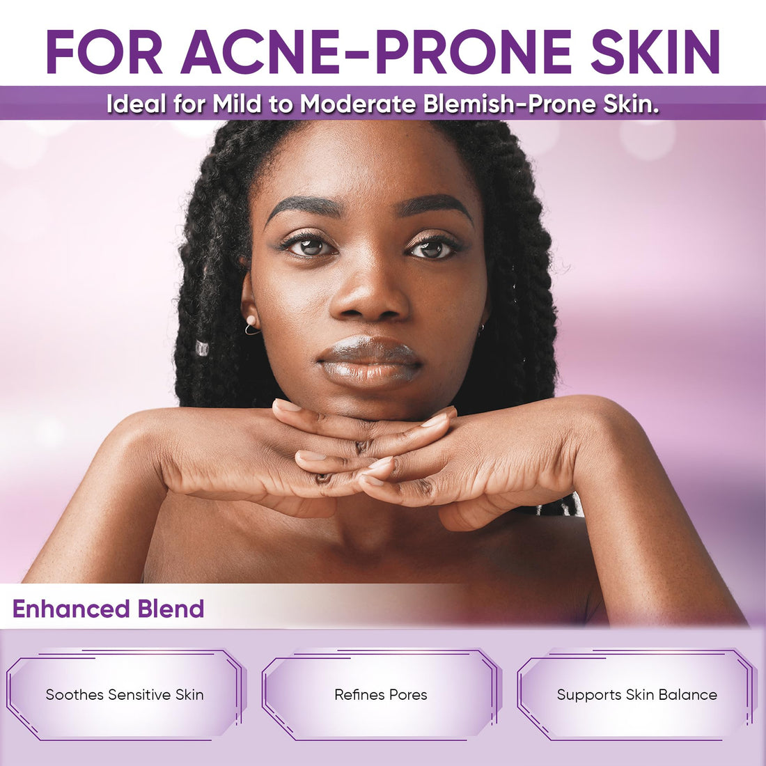 AOBBIY Azelaic Acid Acne Cream: Azelaic Acid For Face - Premium Azelaic Acid Cream - Face Skin and Beauty Care - Azelaic Acid Facial Cream, 1 Oz