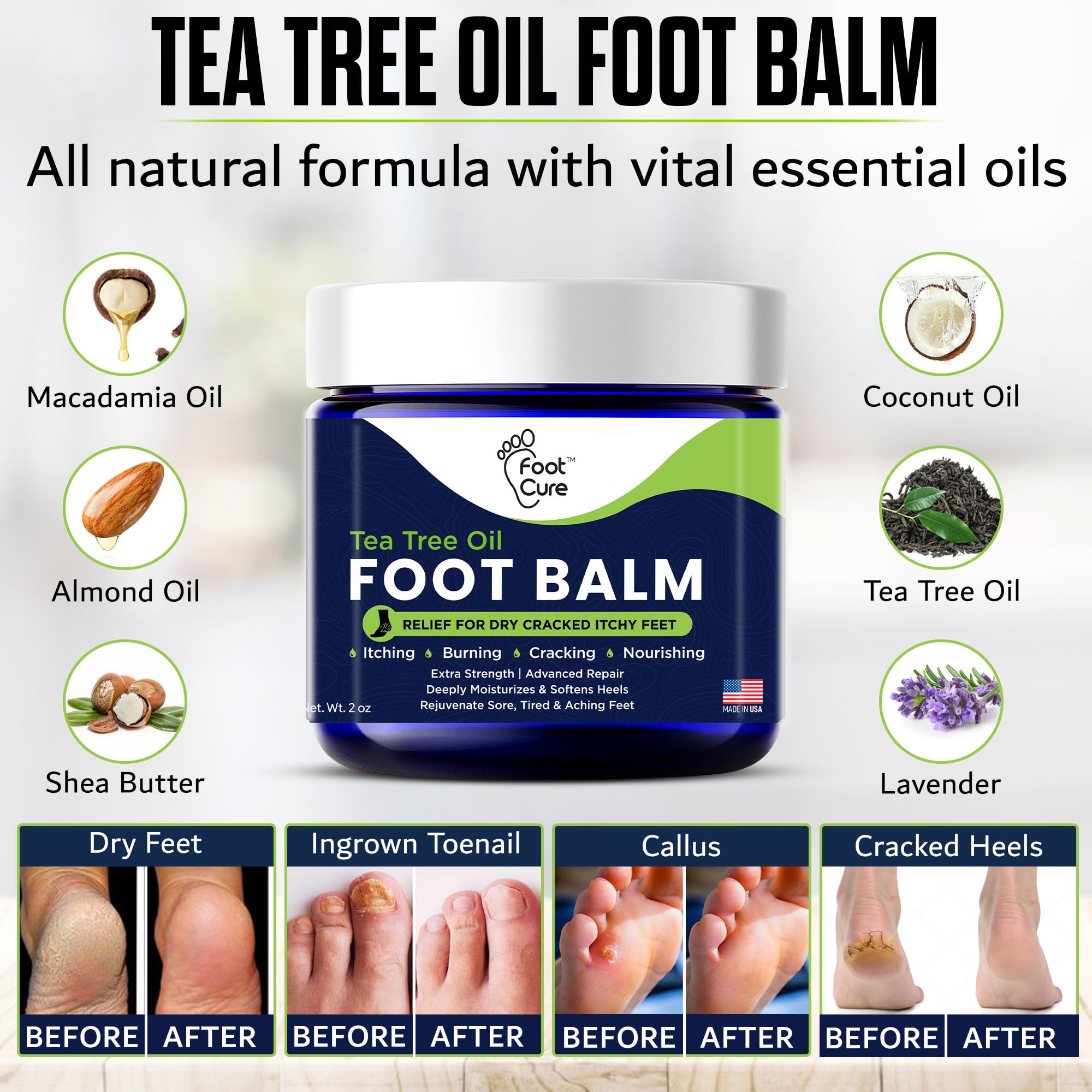 Tea Tree Oil Balm – Moisturizer for Dry Cracked Feet – Instantly Hydrates & Soothes Irritated Skin & Athlete's Foot – Best Care for Women and Men – Made in USA