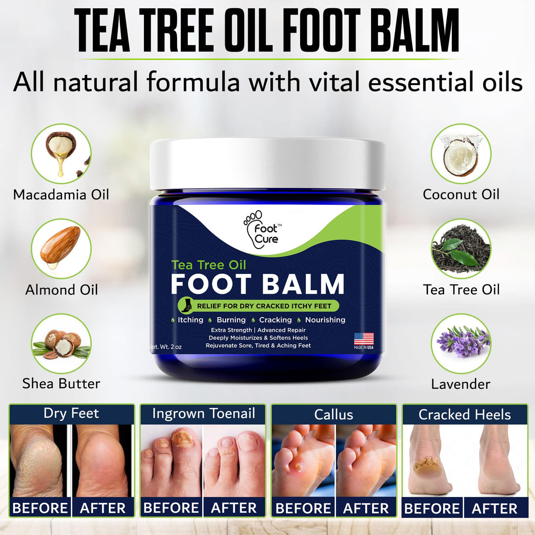 Tea Tree Oil Balm – Moisturizer for Dry Cracked Feet – Instantly Hydrates & Soothes Irritated Skin & Athlete's Foot – Best Care for Women and Men – Made in USA