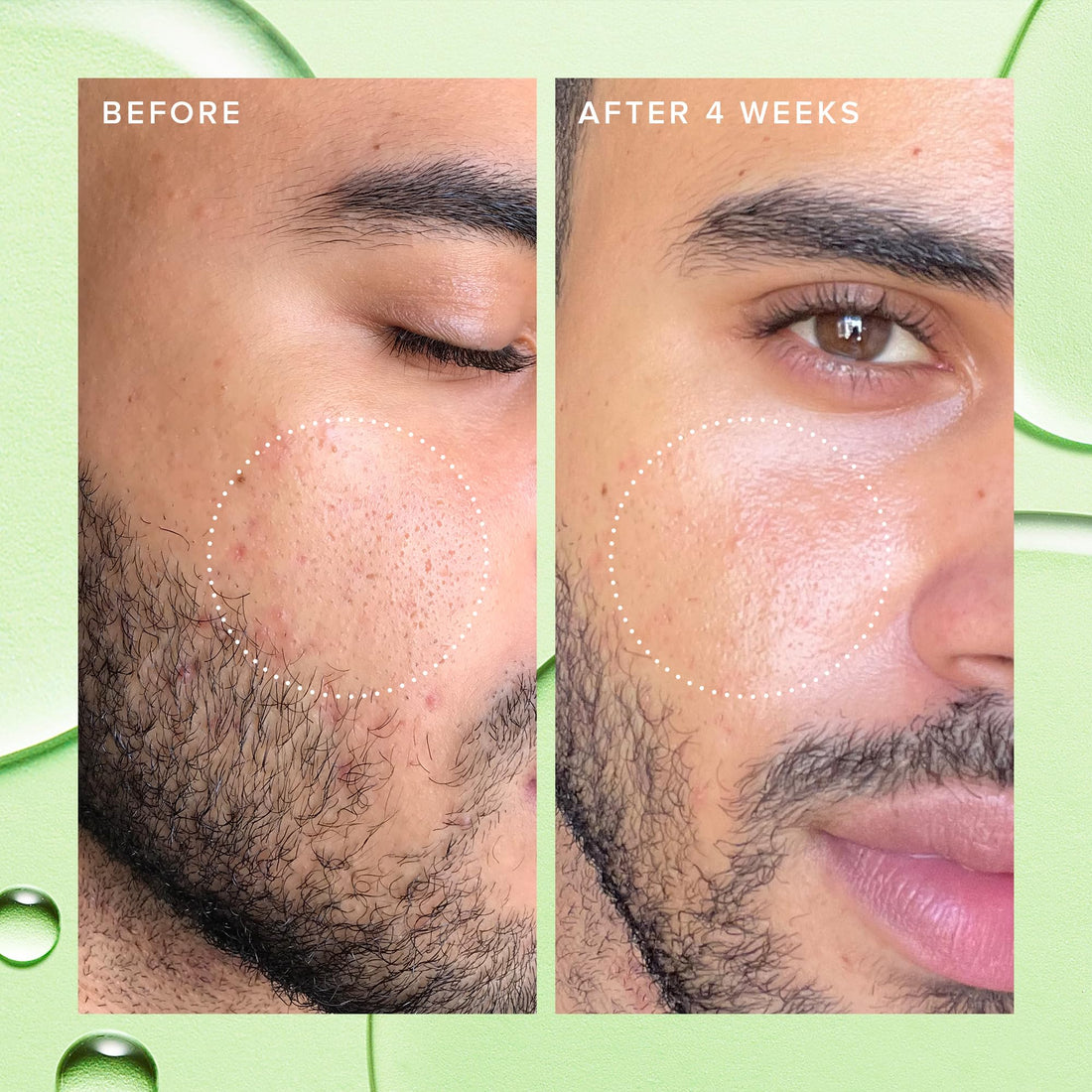 Farmacy 2% Salicylic Acid Toner for Face - Deep Sweep Gentle BHA Exfoliant for Oily Skin - Refines Texture with Papaya Enzymes & Moringa Water for a Healthy-Looking Complexion (50ml)