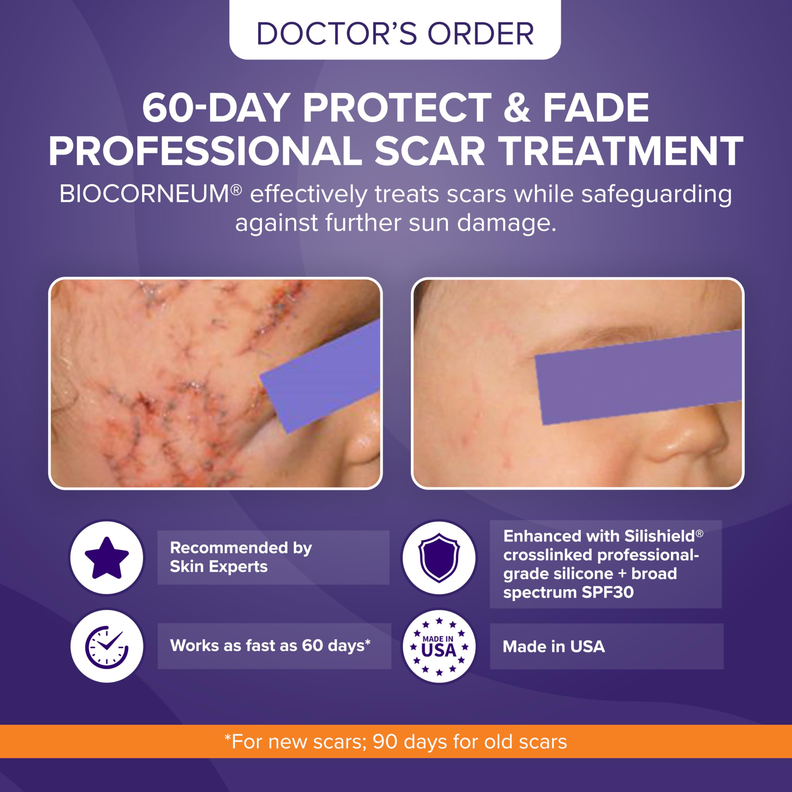 bioCorneum Plus SPF 30 Advanced Scar Supervision (Size 10 gram)