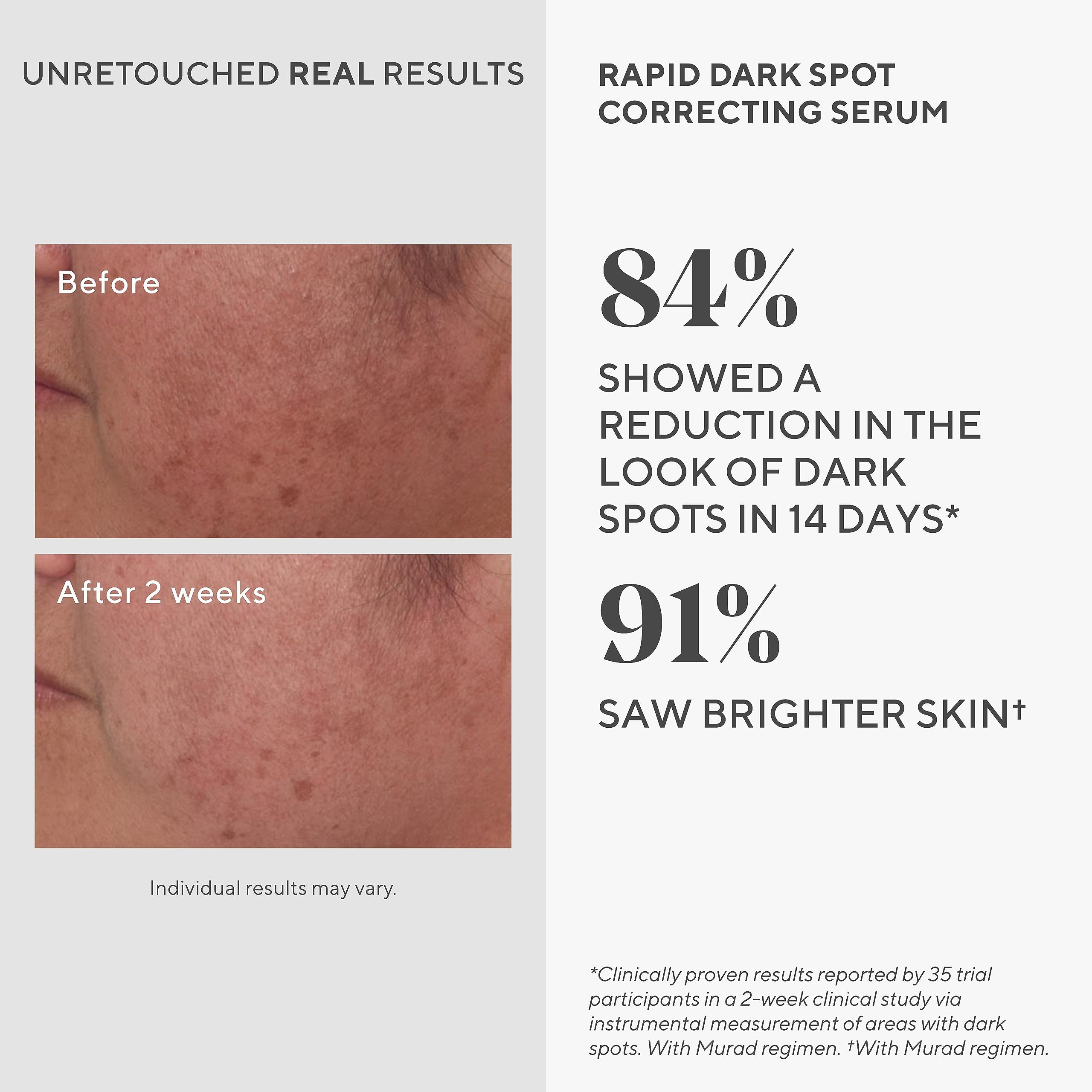 Murad Rapid Dark Spot Correcting Serum – Skin Brightening Face Serum for Hyperpigmentation - Dark Spot Remover for Face - Glycolic Acid Treatment - Skin Care Backed by Science - 1 Fl Oz