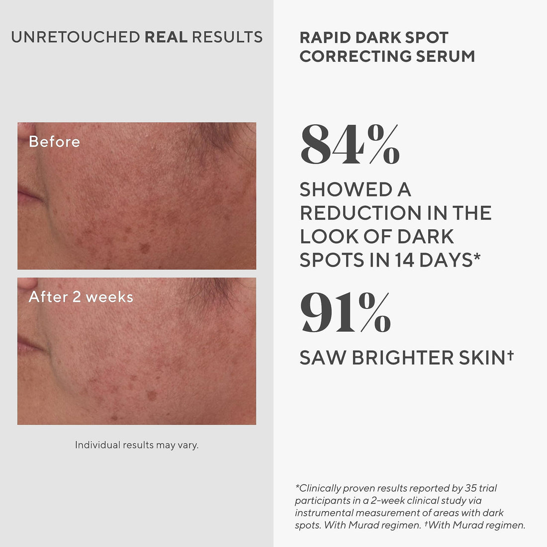 Murad Rapid Dark Spot Correcting Serum – Skin Brightening Face Serum for Hyperpigmentation - Dark Spot Remover for Face - Glycolic Acid Treatment - Skin Care Backed by Science - 1 Fl Oz