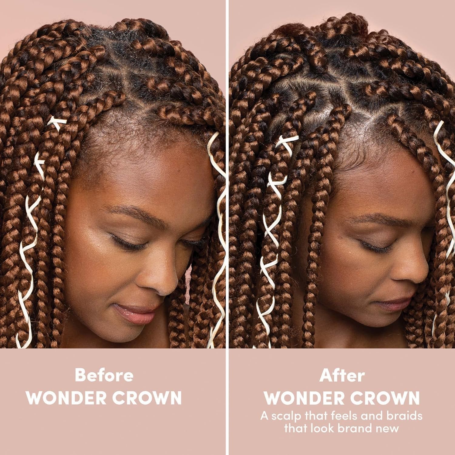 MIZANI Style Shifter Society Wonder Crown Scalp Foaming Pre-Cleanse | Scalp Cleanser that Removes Buildup | For Dry, Textured Hair | 6.8 Fl. Oz.
