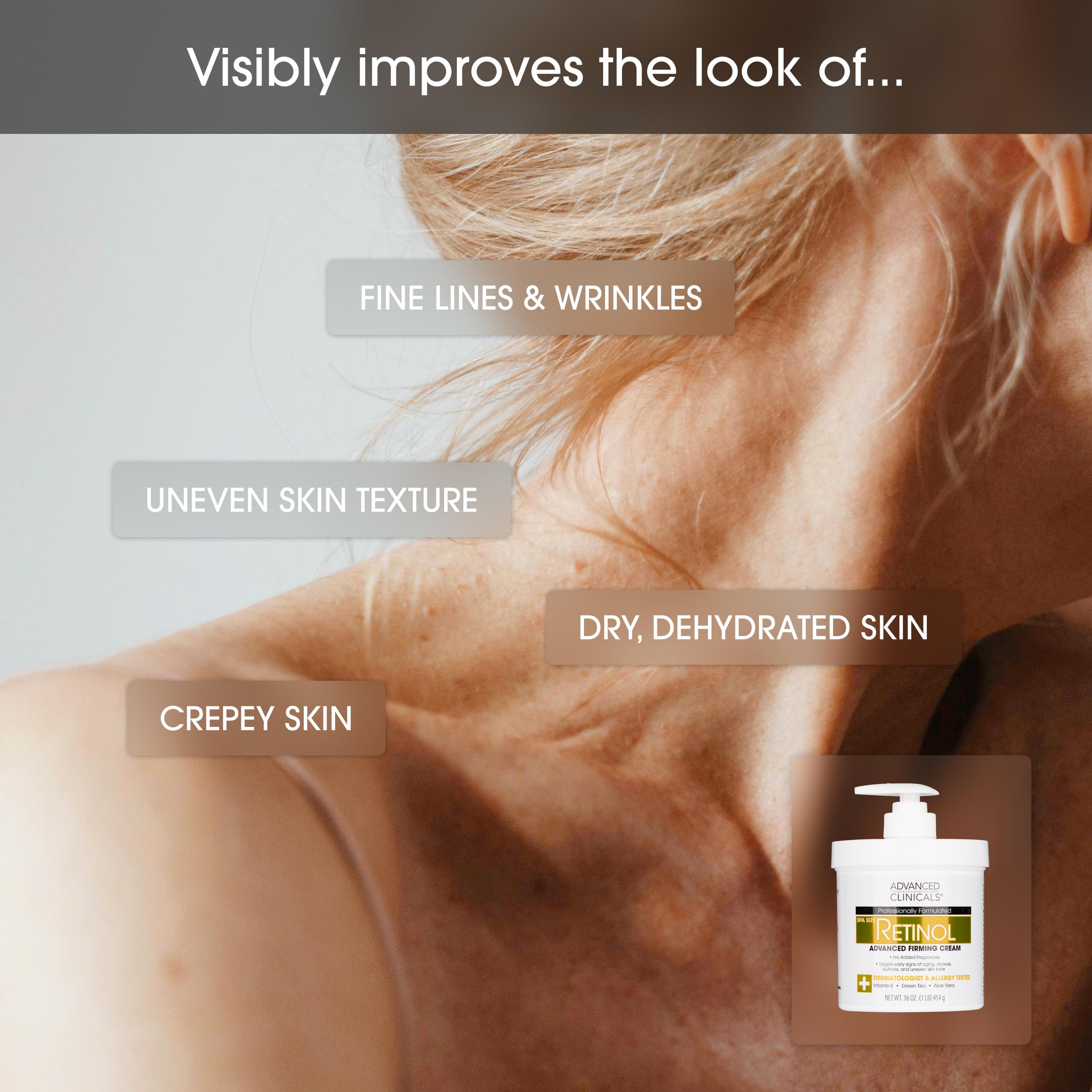 Advanced Clinicals Retinol Body Lotion + 10% Glycolic Acid & Lactic Acid Exfoliating Body Cream Moisturizer | Crepey Skin Care Treatment | AHA KP Bump Eraser | Keratosis Pilaris | Fragrance Free, 2PC