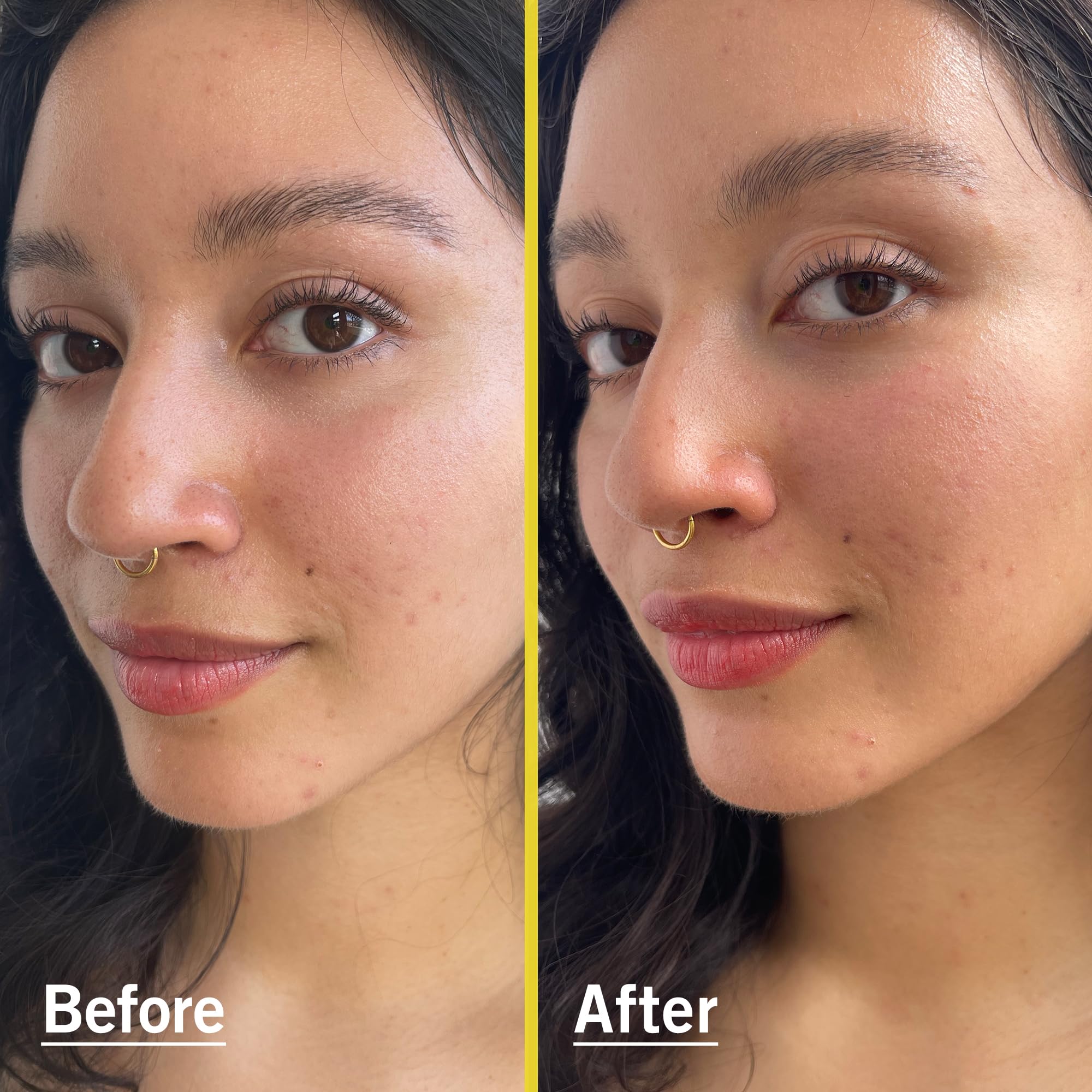 First Aid Beauty - Weightless Liquid Mineral Sunscreen with Zinc Oxide Broad Spectrum SPF 30, Luxuriously Light Ultra Sheer Tint for Everyday Use, Non-comedogenic, Safe for Sensitive Skin, 1.5 oz