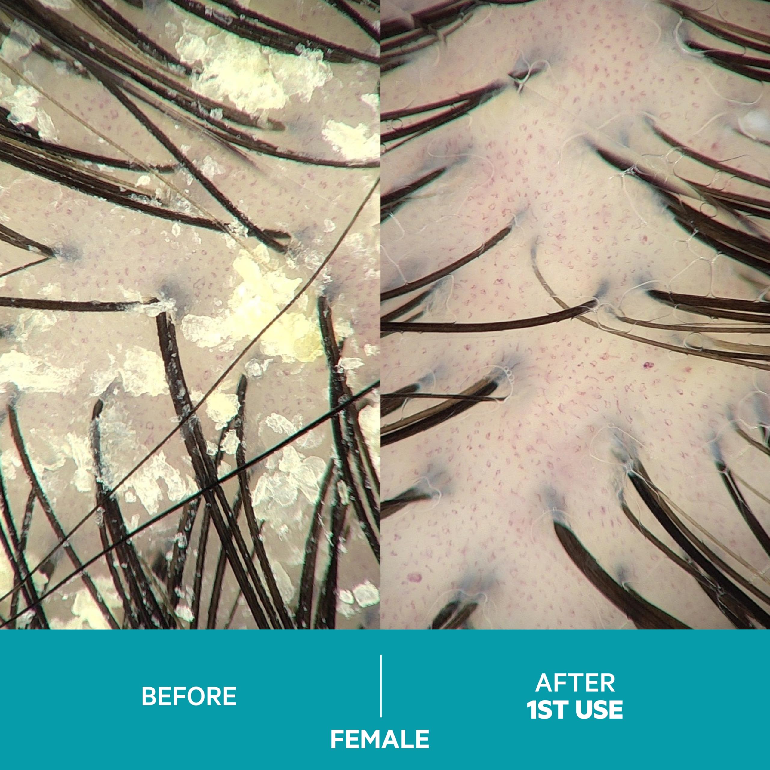 Dandrene Anti-Dandruff Conditioner