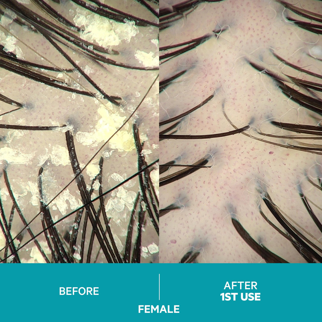 Dandrene Anti-Dandruff Conditioner