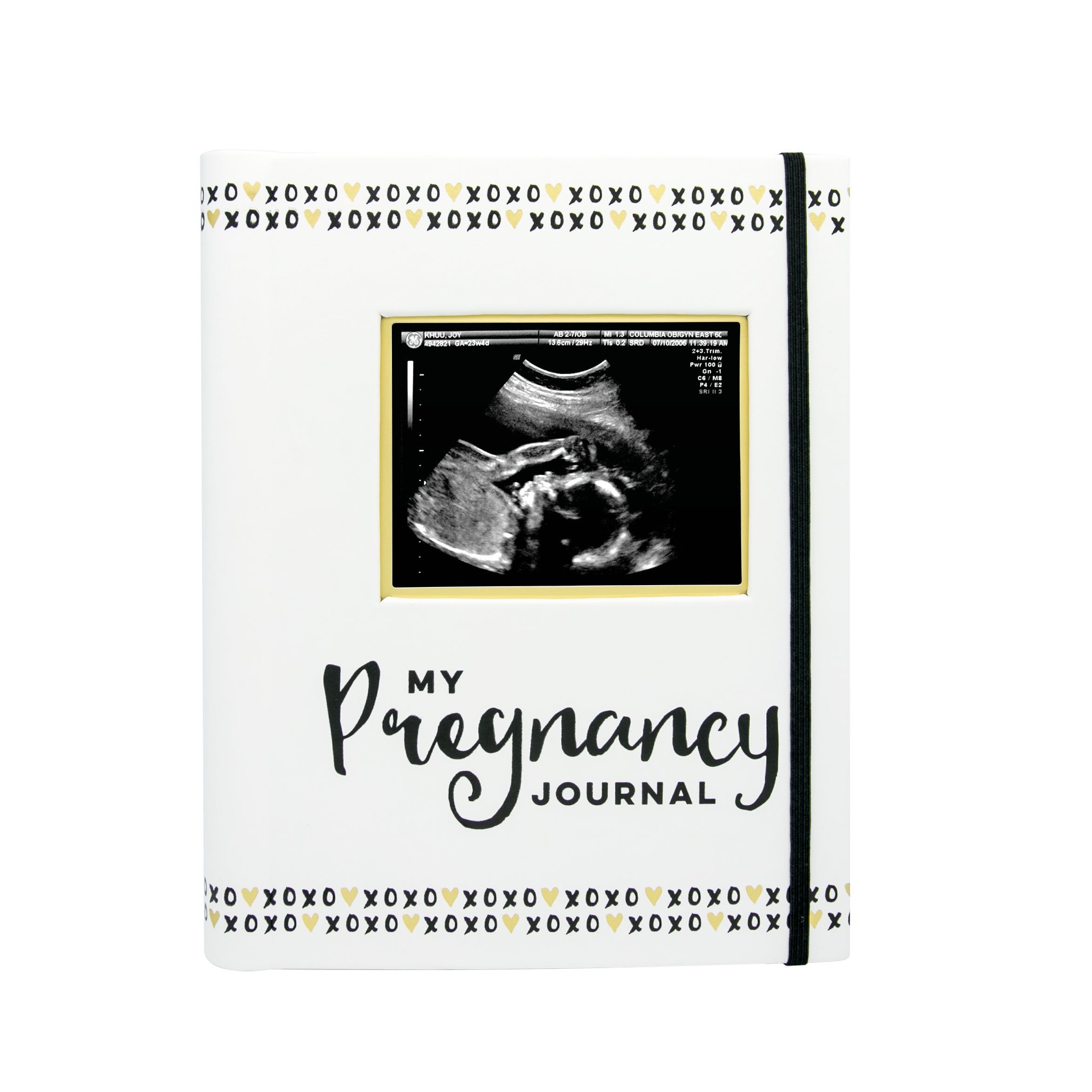 Pearhead My Pregnancy Journal - 74-Page Memory Book and Photo Album, Gender Neutral Planner for Expecting Moms, Includes Milestone Sections and Ultrasound Photo Insert