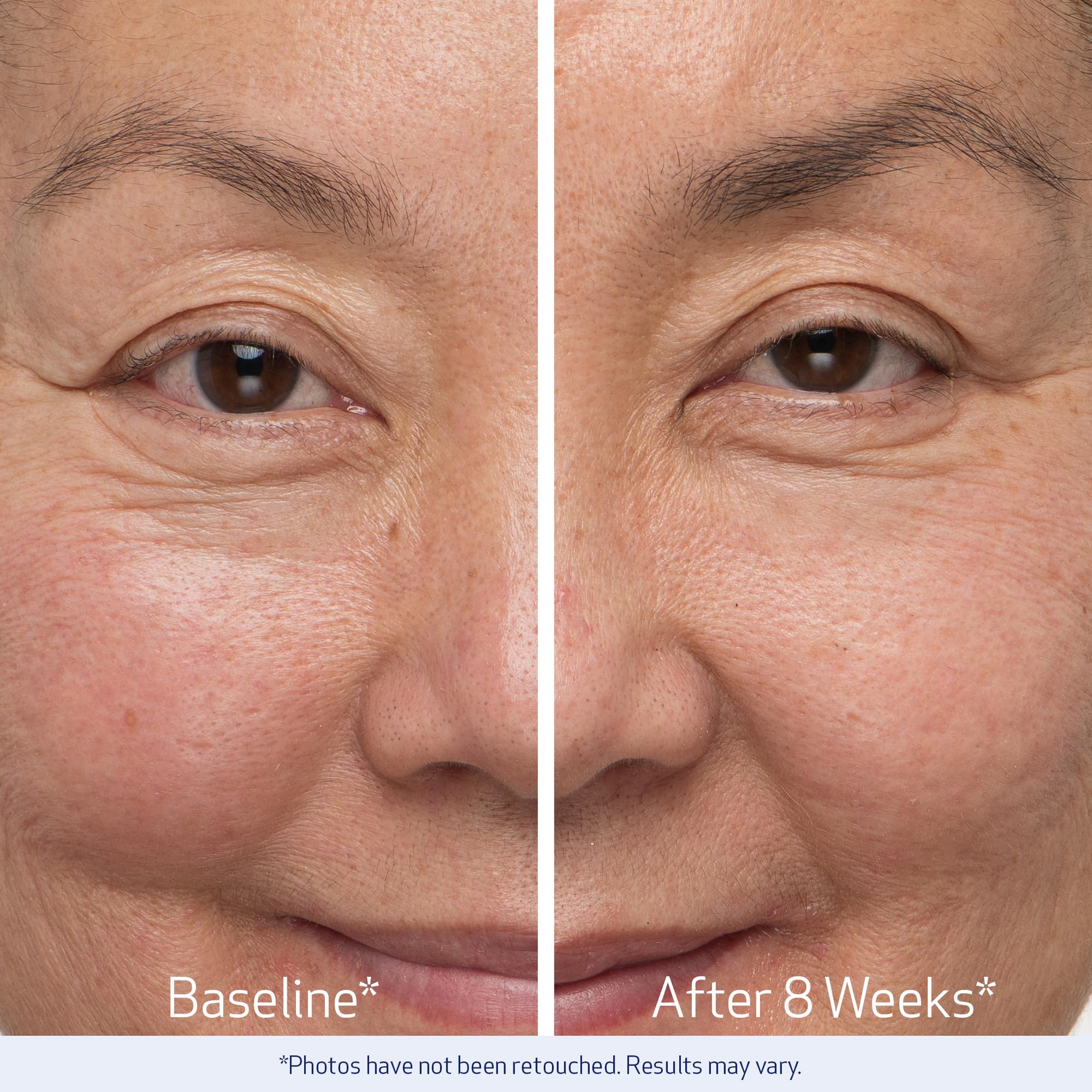 Obagi Nu-Cil Eyebrow Boosting Serum - Eyebrow Growth Serum with Hyaluronic Acid - Eyebrow Serum for Thin, Patchy & Over-Tweezed Eyebrows - Fast Absorbing - 6ml