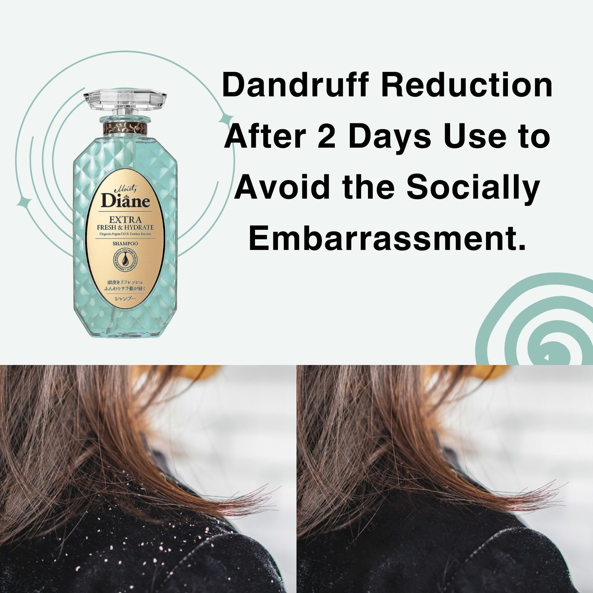 Moist Diane Anti-Dandruff Shampoo and Conditioner Set for Dry Hair& Itchy Scalp Women & Men, Keratin Shampoo by Protein & Argan Oil from Japan, Silicone& Sulfate Free, EXTRA FRESH& HYDRATE, 30.4 Fl Oz