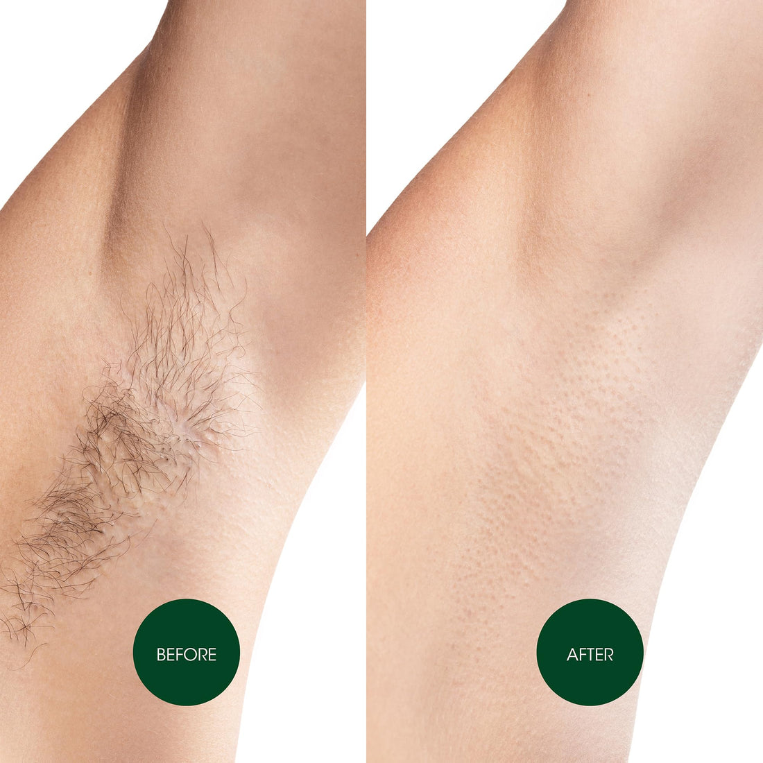 Nad's Body Wax Strips, 20 Count