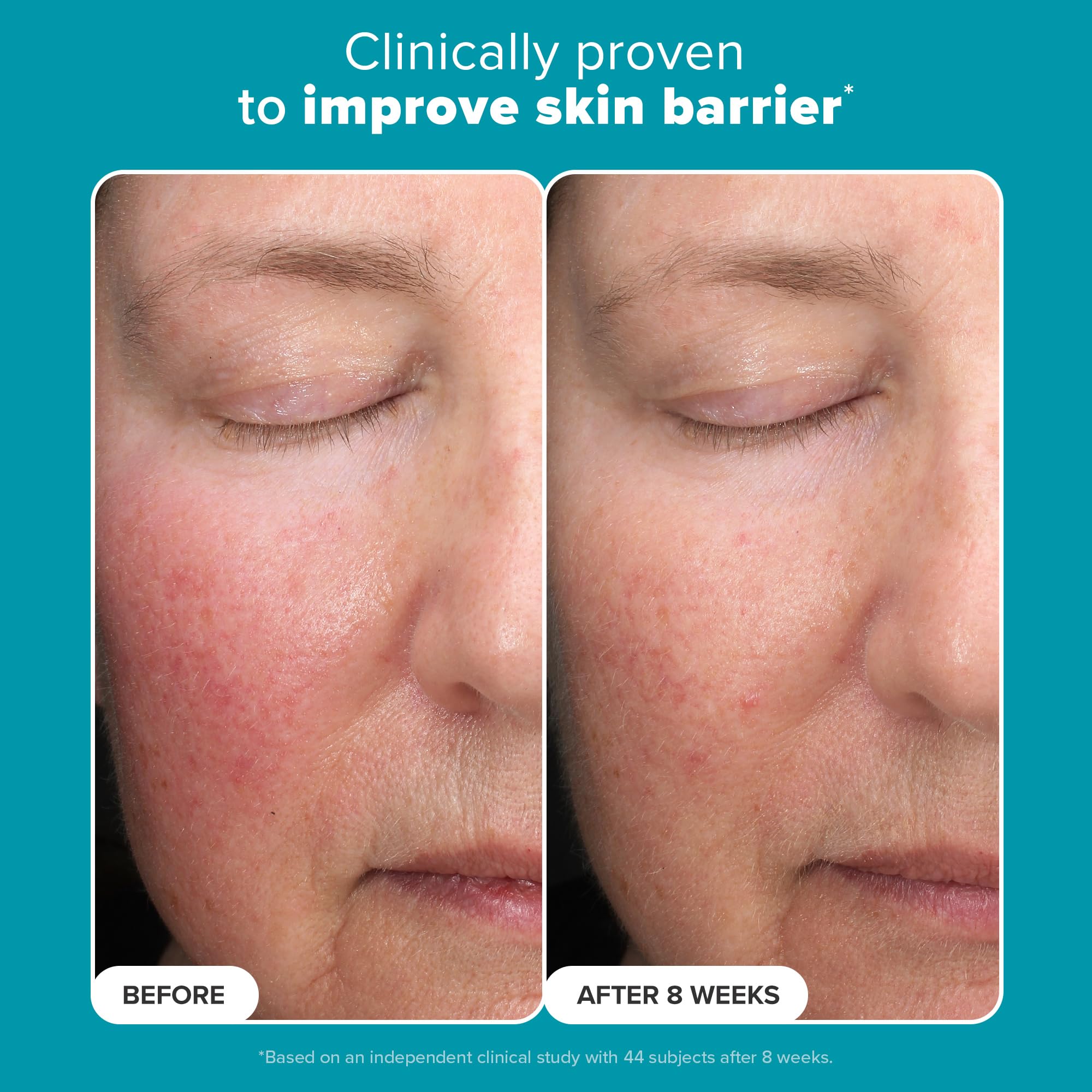 Paula’s Choice 6% Mandelic Acid + 2% Lactic Acid Exfoliant, Gentle Daily AHA Exfoliation for Discoloration, Bumpy Texture & Radiance, for Sensitive Skin, Fragrance-Free & Paraben-Free, 1 Fl. Oz.