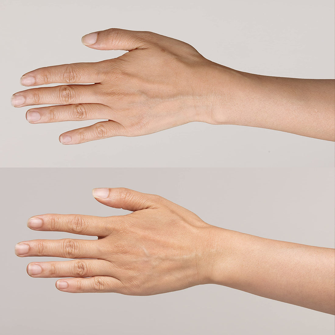 Instant Effects HAND SUPER SERUM 30ml - 24 Hour Recovery Cream For Anti-Ageing, Wrinkles, Dryness, Age Spots & Pigmentation, Sun Damage (I0110512)