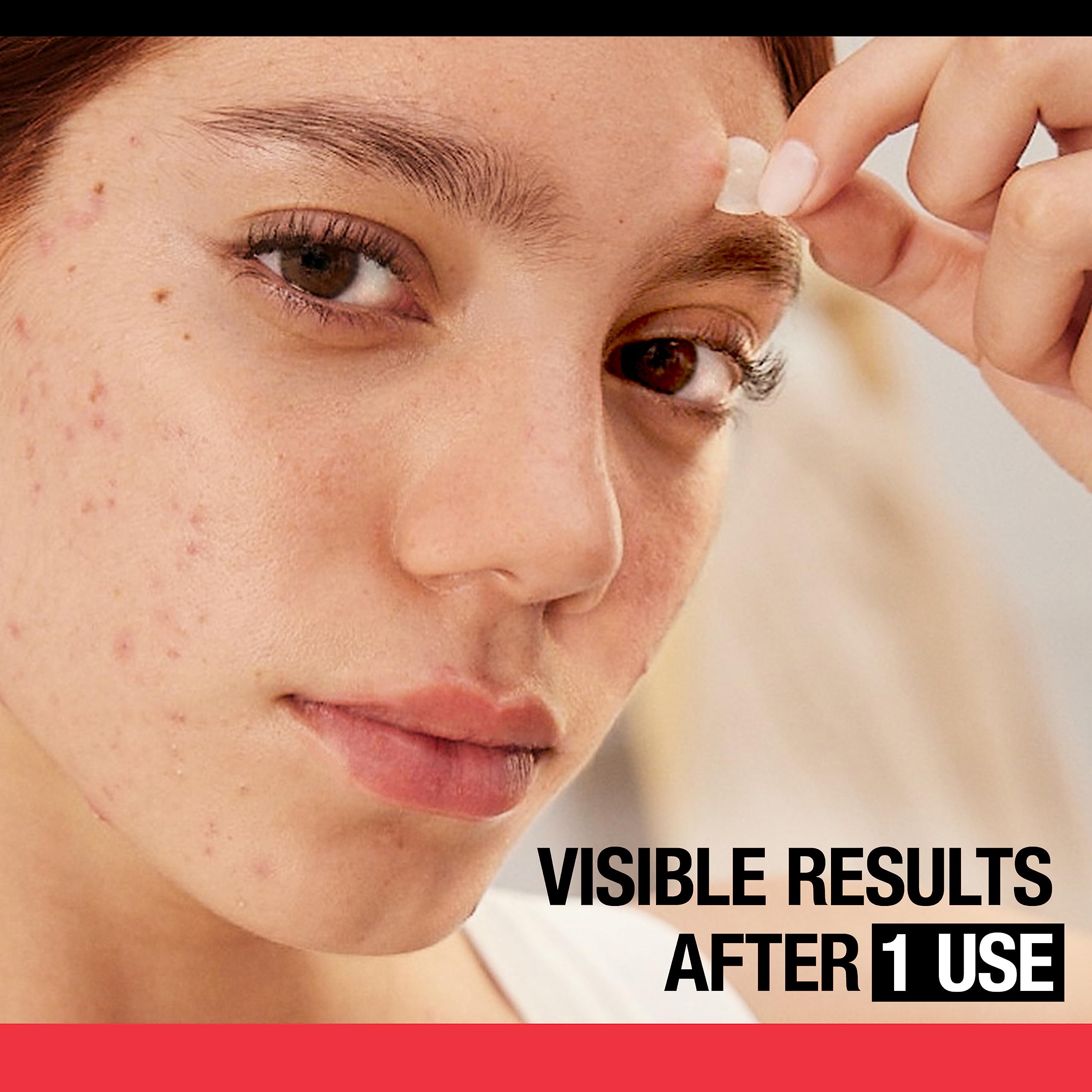 Neutrogena Stubborn Acne Blemish Patches Combination Pack, Ultra-Thin Hydrocolloid Acne Patch Absorbs Fluids & Removes Impurities To Help Pimples Look Smaller, 2 Sizes, 16 Patches