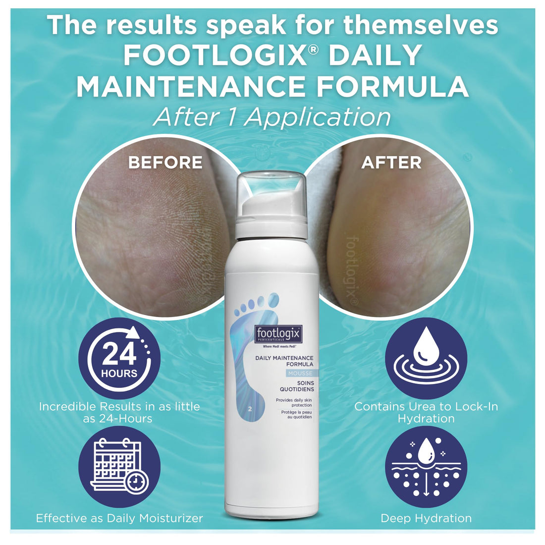 Footlogix Daily Maintenance Formula, 4.2 Ounce
