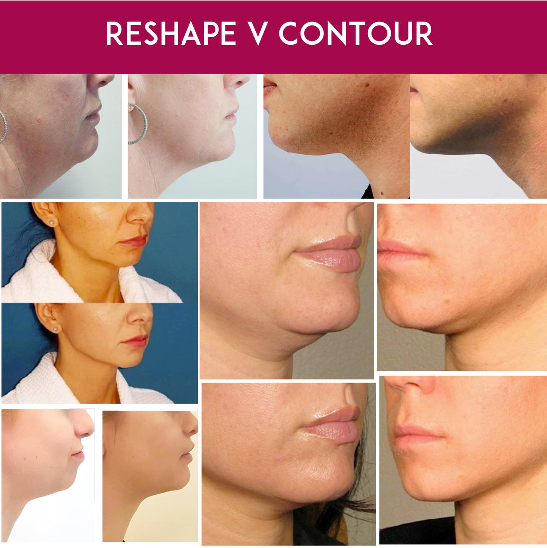Mira Pack Hydrogel 2-step Masking System for Face Neck Hydrating Skin Brighteners, Anti aging