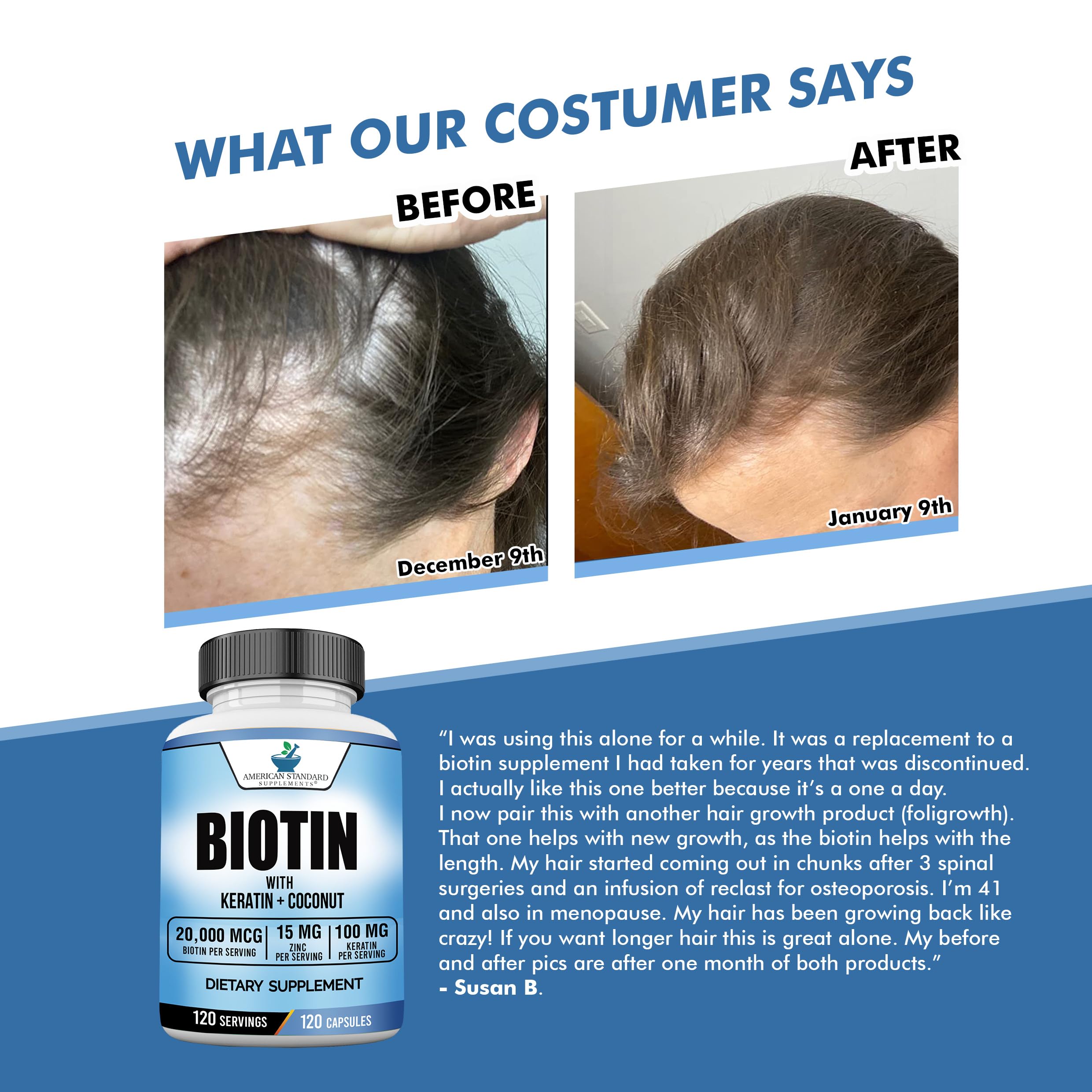 Biotin 20,000mcg with Keratin, Coconut Powder and Zinc, Hair Growth Supplements, Biotin Supplements, Healthy Hair Skin & Nails for Adults,120 Veggie Capsules, 120 Day Supply
