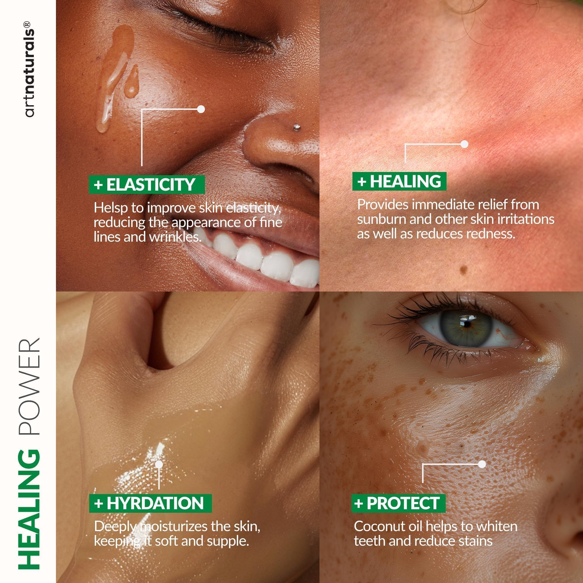 artnaturals Aloe Vera Gel Set - JUMBO 20oz (99% Pure Organic) - Sunburn Relief & Hydration for Face, Body, Scalp & Hair - Calming Moisturizer After Sun Exposure - Freshly Harvested within 12 Hours