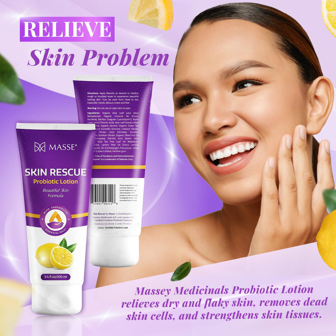 Candida Freedom Massey's Skin Rescue Probiotics Lotion - Daily lotion for Men & Women - Refreshing Lemon Scent - Non-Greasy Moisture for Smooth & Sensitive Skin - 3.4 oz