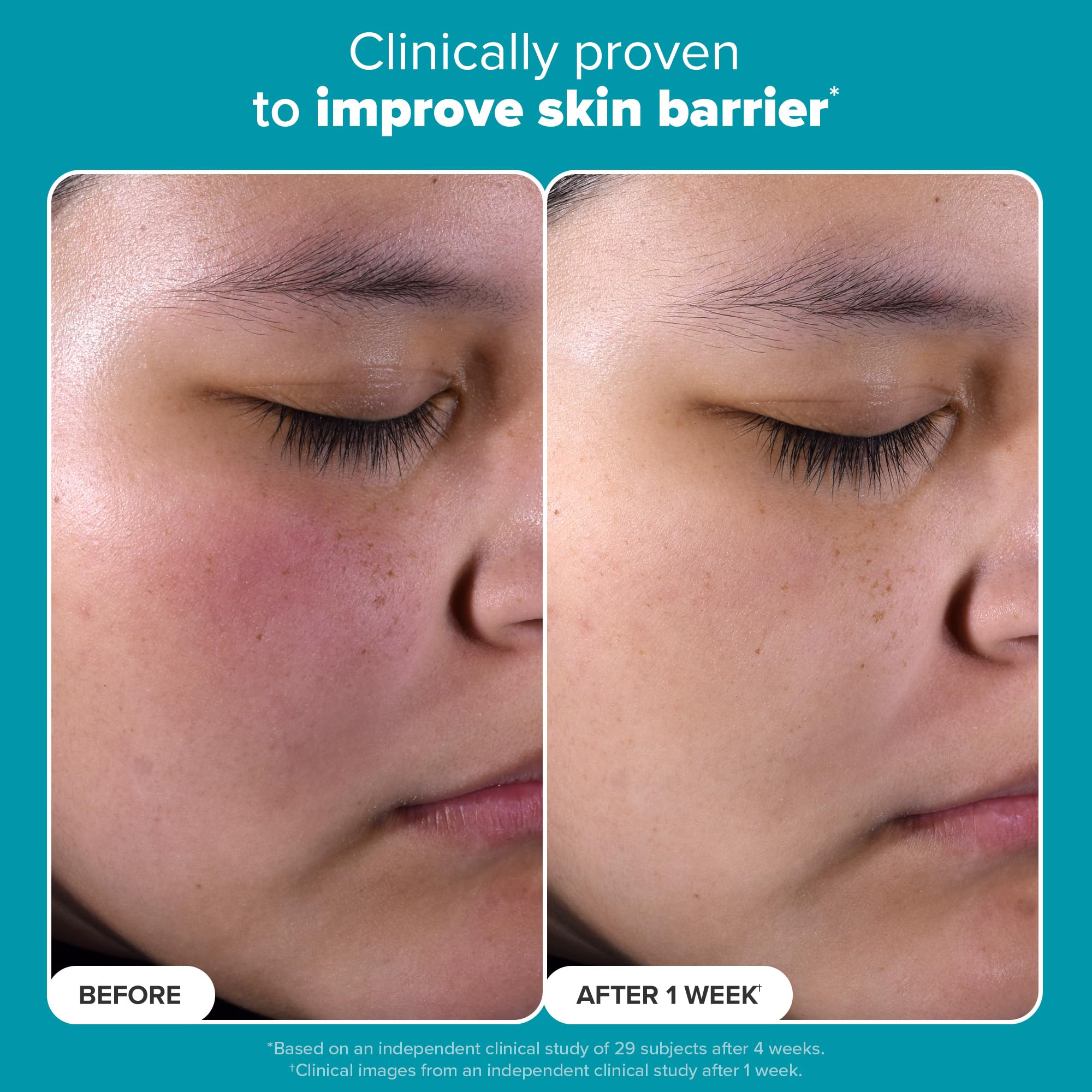 Paula's Choice SKIN PERFECTING 2% BHA Liquid Salicylic Acid Exfoliant-Facial Exfoliant for Blackheads, Enlarged Pores, Wrinkles & Fine Lines