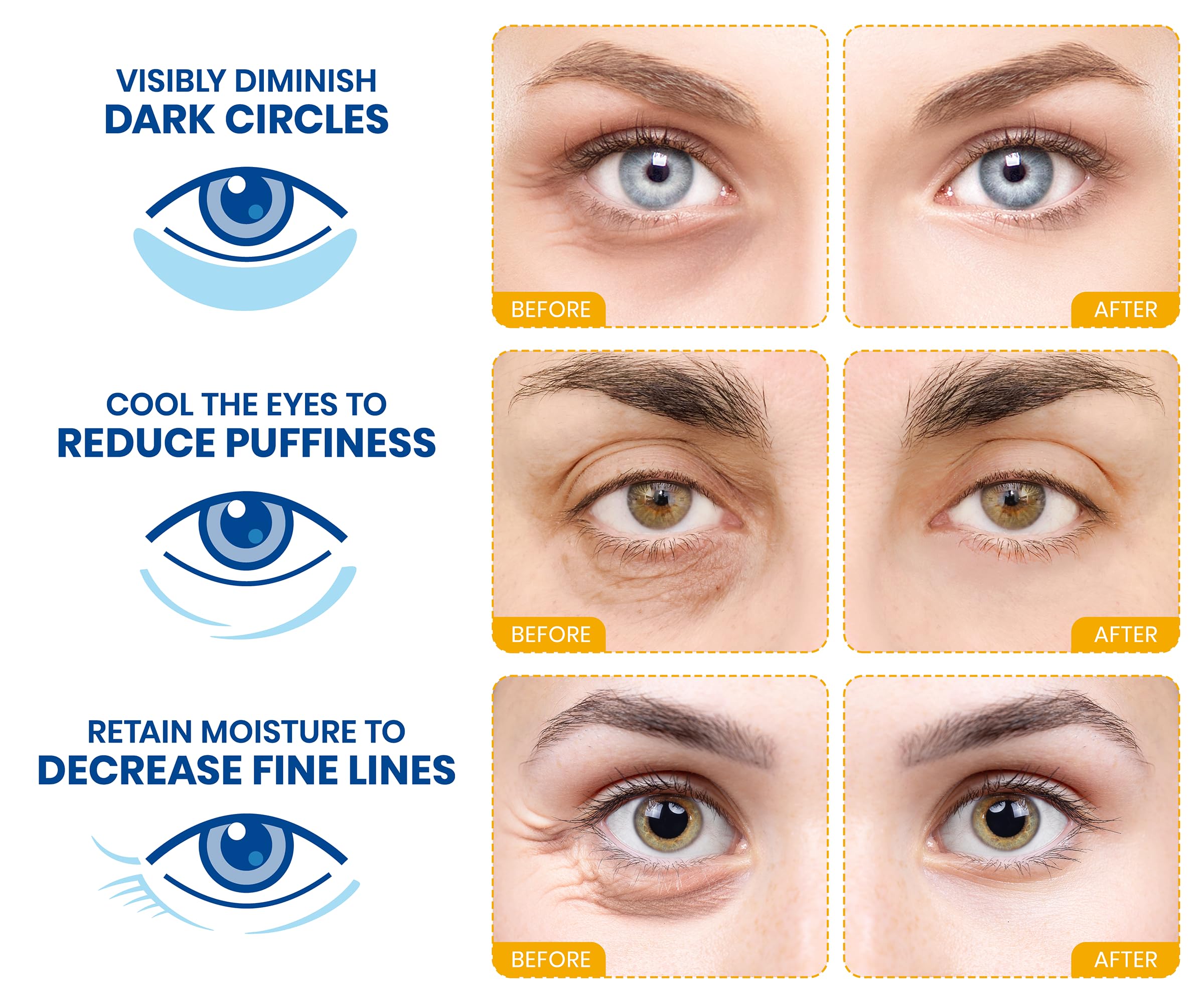 Stylia Under Eye Patches for Dark Circles and Puffy Eyes (20 Pairs) - 24k Gold Collagen Mask with Hyaluronic Acid, Eye Masks for Dark Circles and Puffiness, Gifts for Women, Valentines Day Gifts