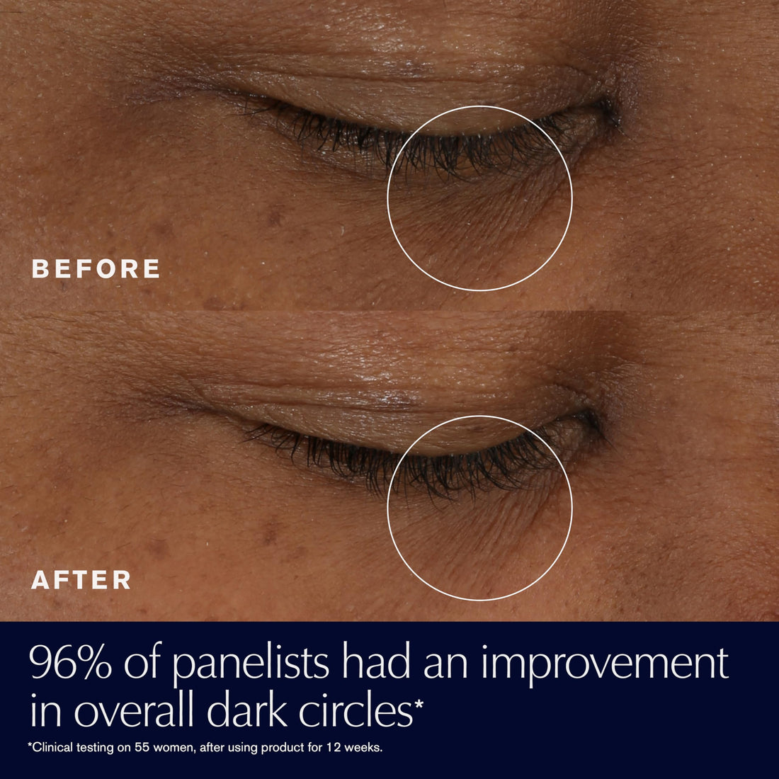 Estée Lauder Advanced Night Repair Eye Supercharged Gel-Cream Synchronized Multi-Recovery | Under Eye Cream for Dark Circles, 0.5 Fl Oz