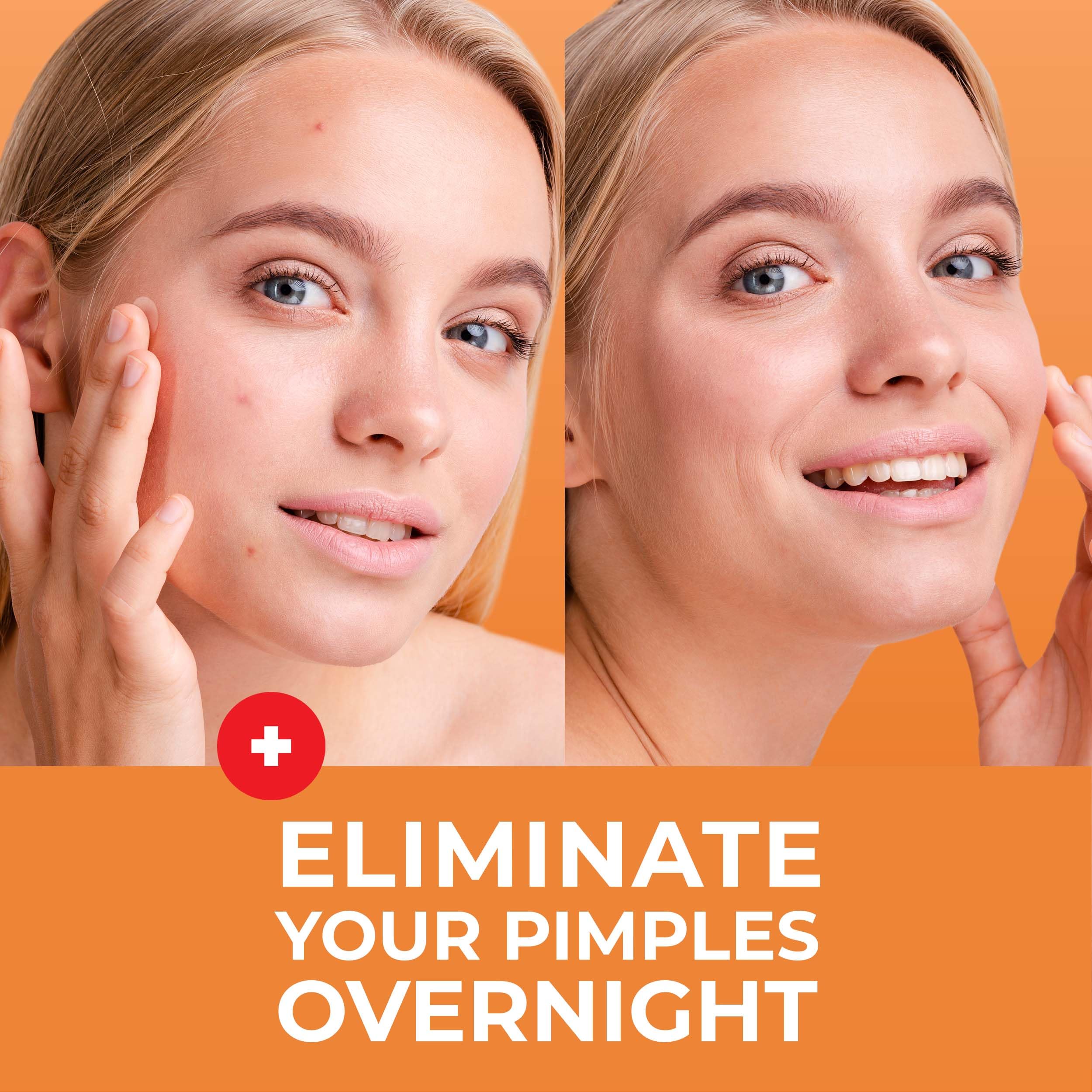 PatchRx Acne Patches (120 Count) with Hydrocolloid Only, Hydrocolloid Pimple Patches for Face - Zit Patch Acne Dots - Acne Patches - Pimple Patch with 3 Size Acne Stickers