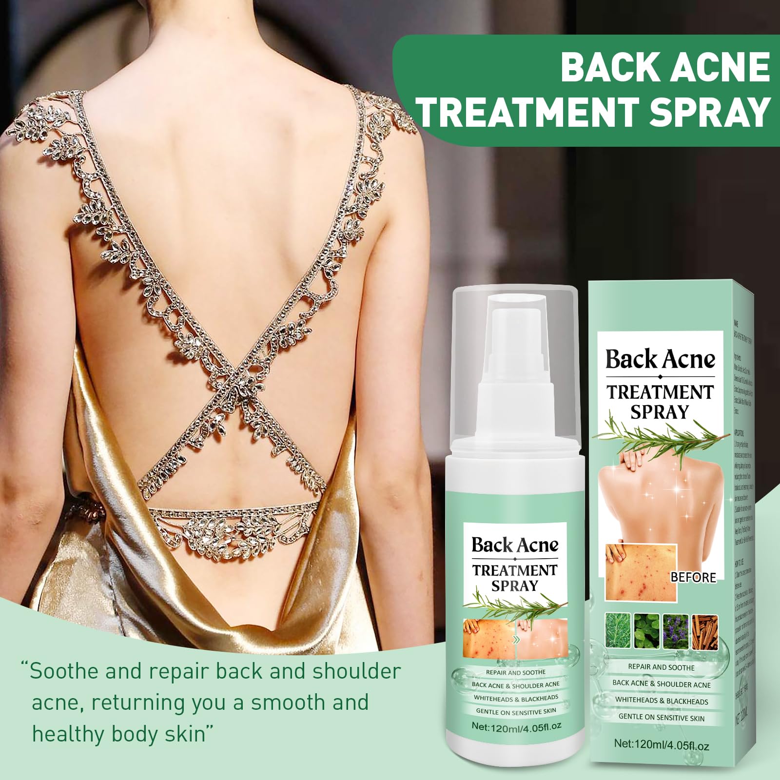 Back Acne Treatment With Herbal Formula, 2% Salicylic Acid & Tea Tree Oil - Body Spray Solution for Acne, 120ml (2PCS)