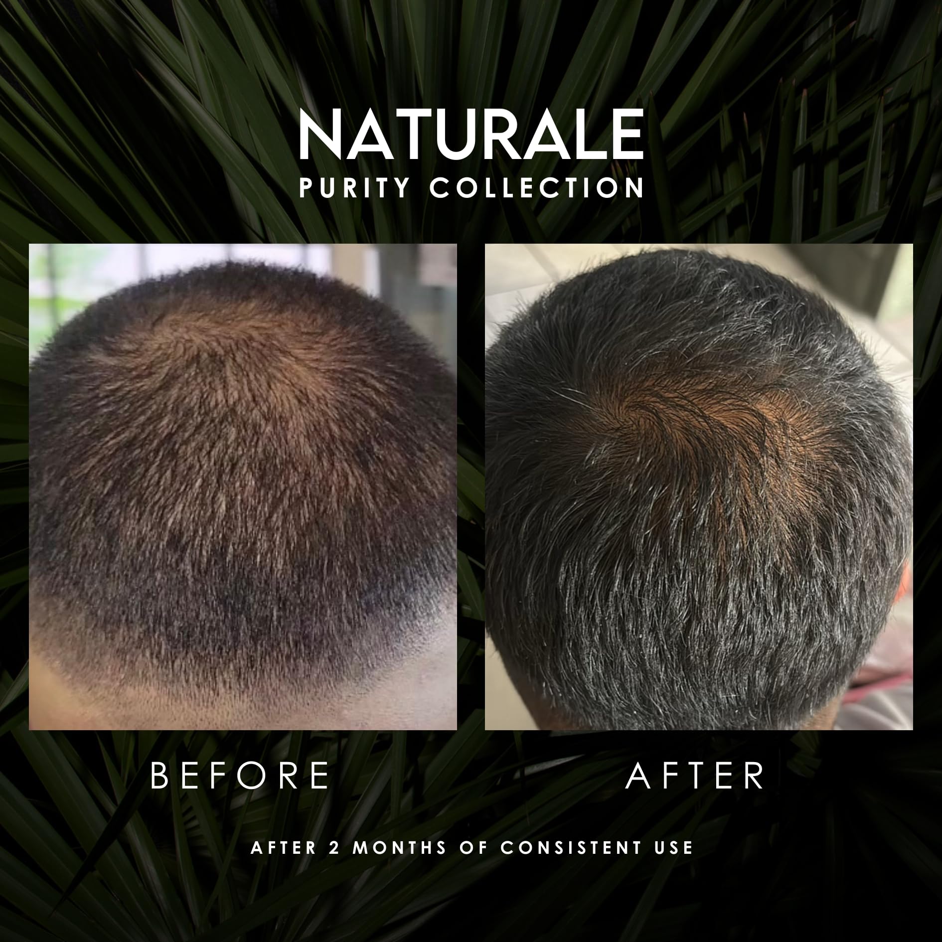 ORIGENERE Conditioner for Thinning Hair/Hairloss. All Natural Formula. Blend Of Saw Palmetto, Hops, Sage, Fenugreek, Provitamin B5, And Hydrolyzed Soy Protein.