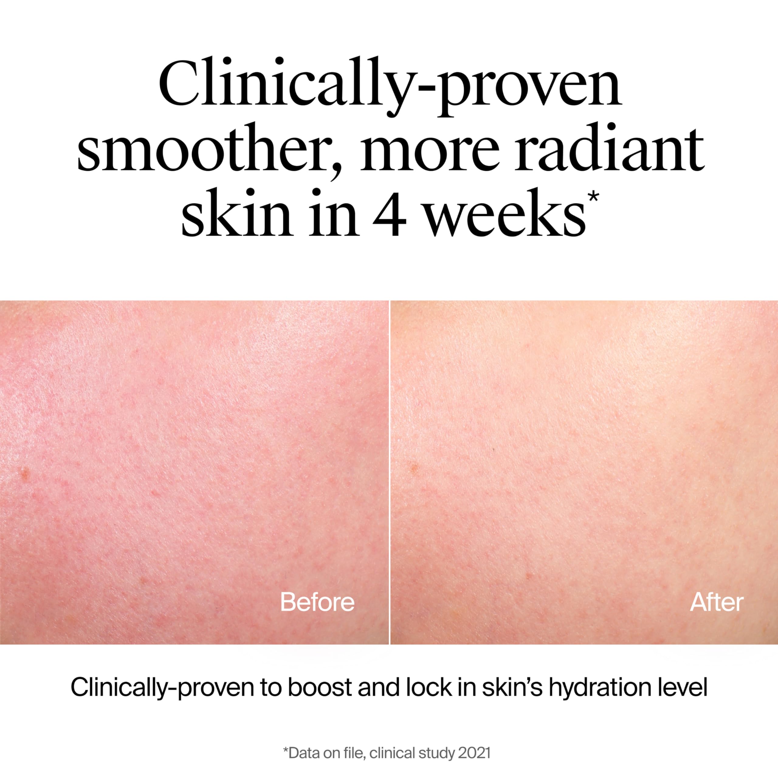 Neutrogena Hydro Boost Face Wash, Fragrance Free, Hydrating Facial Cleanser with Hyaluronic Acid, Daily Foaming Face Wash & Makeup Remover, Hypoallergenic Gel Cleanser, 12 fl. oz