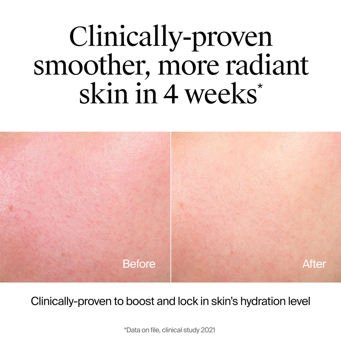 Neutrogena Hydro Boost Face Wash, Fragrance Free, Hydrating Facial Cleanser with Hyaluronic Acid, Daily Foaming Face Wash & Makeup Remover, Hypoallergenic Gel Cleanser, 12 fl. oz