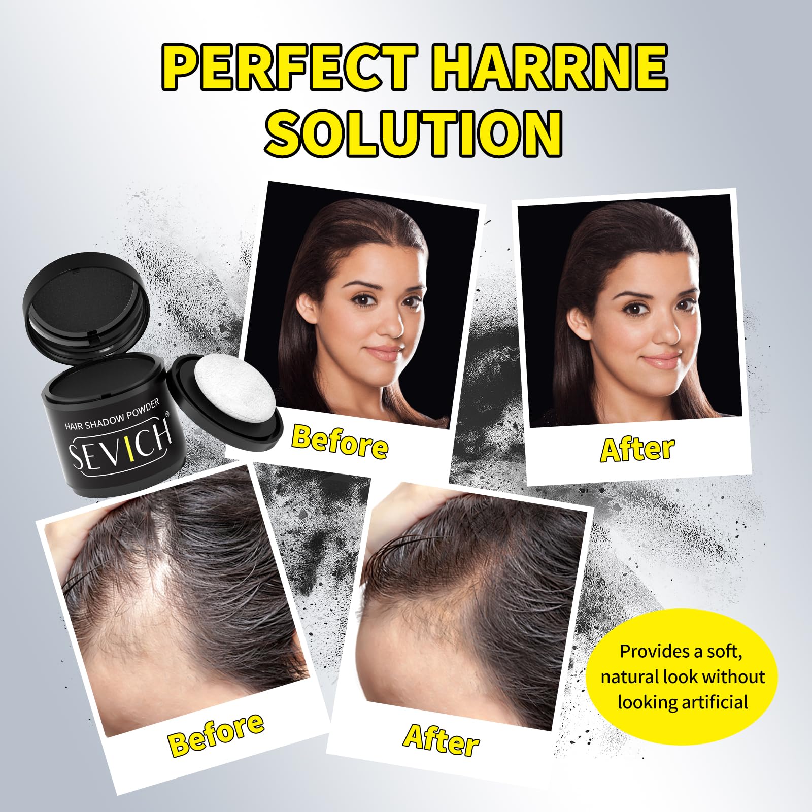 Sevich Hairline Powder 10g with Brush, Instantly Conceals Hair Loss & Thinning & Gray, 48H Waterproof Root Touch Up Powder, Natural Hair Shadow Toppers for Women & Men, 1 Box = 2.5 Boxes,Med Brown