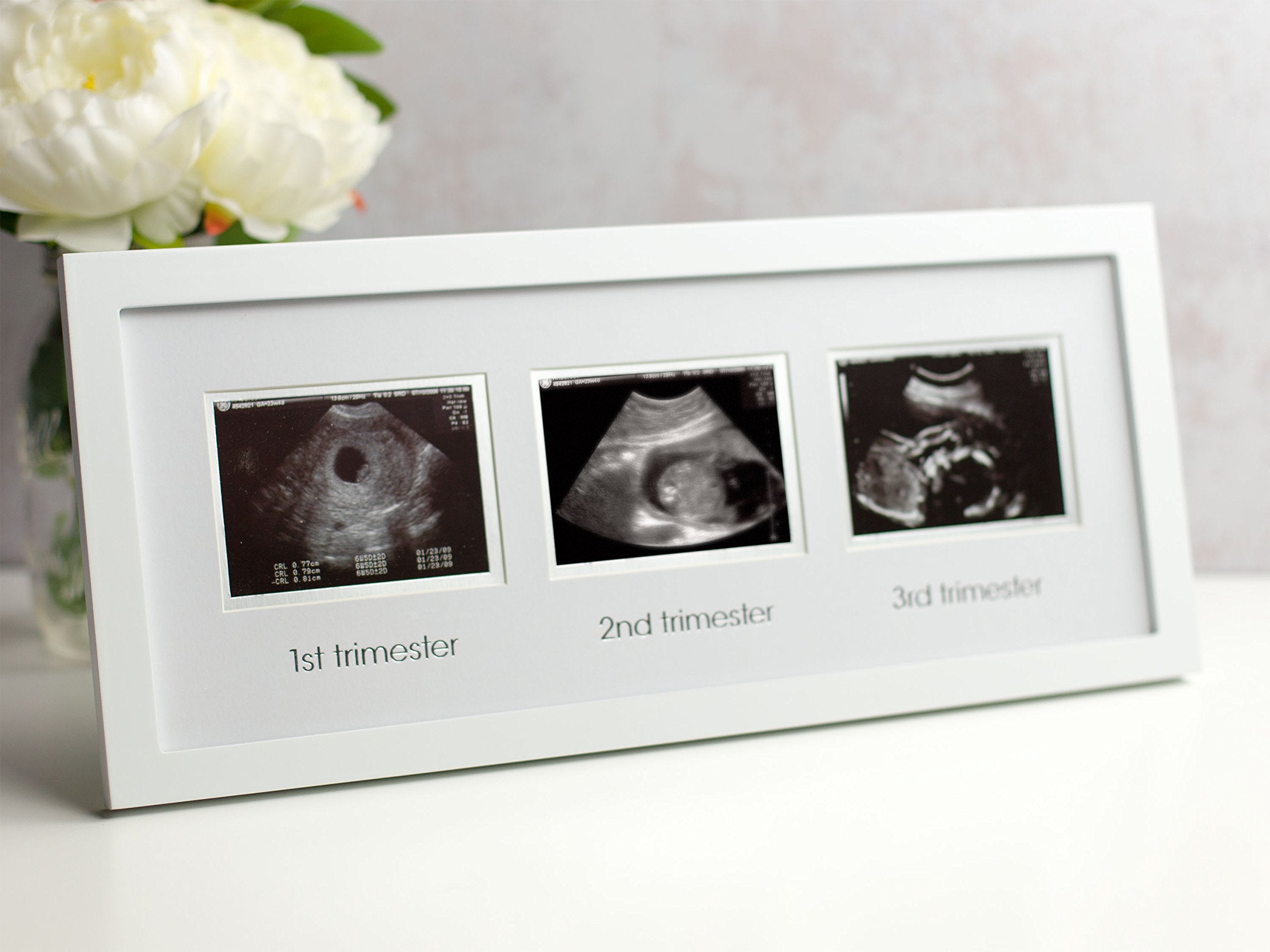 Pearhead Sonogram Progression Frame - Trimester by Trimester Pregnancy Milestone Keepsake, Gender-Neutral Nursery Decor, Displays 1st, 2nd & 3rd Trimester Ultrasound Photos, White