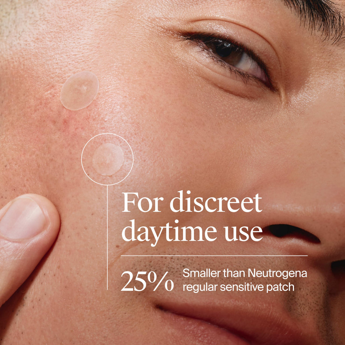 Neutrogena Mini Acne Patches for Sensitive Skin, Small Hydrocolloid Acne Spot Treatment Reduces the Look of Blemishes in 6-8 Hours, Gentle Non-Medicated Blemish Patches, 36 ct