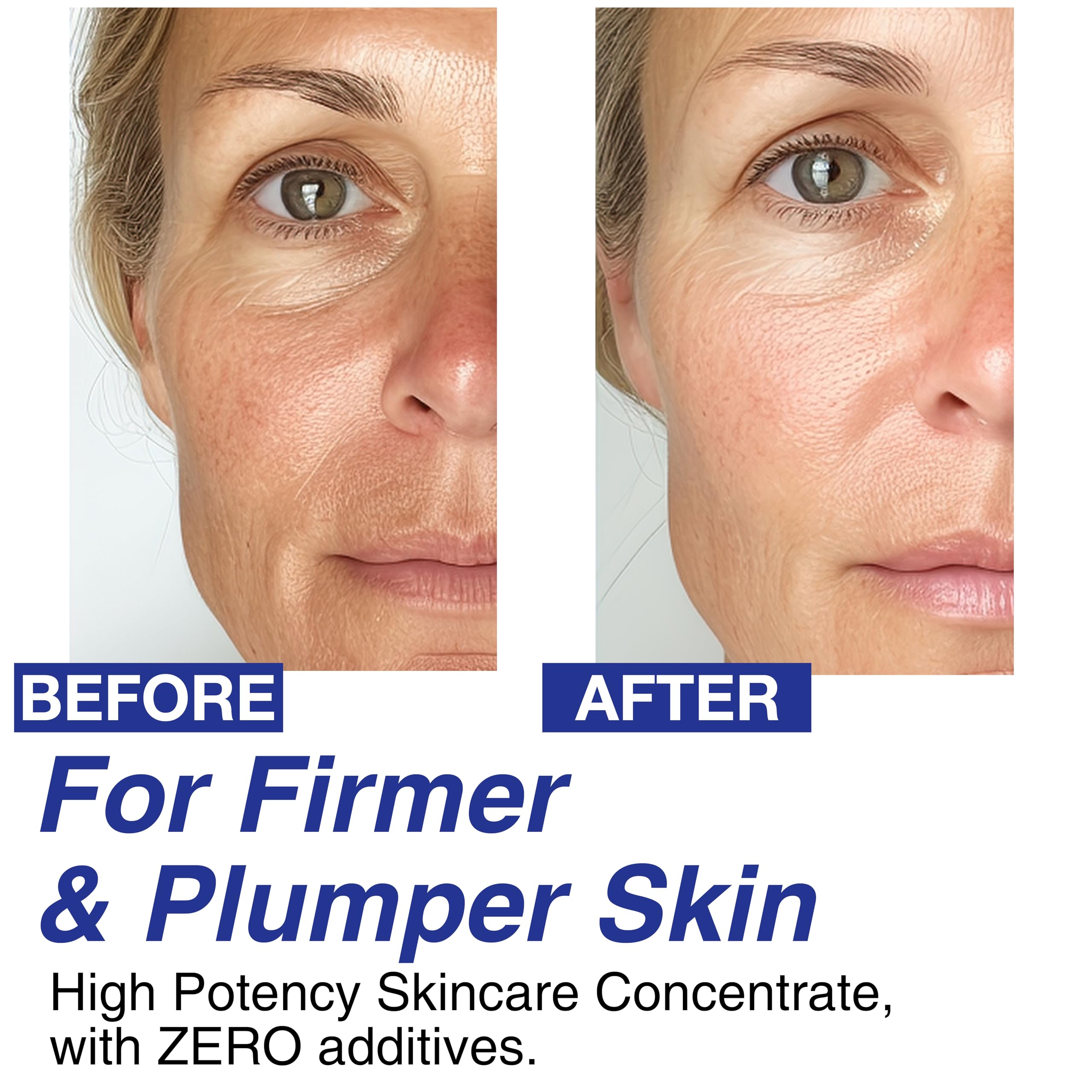 CELDYQUE 100% Pure Volufiline Concentrate Mix-in Serum - Skin Firming Solution & Clinically Proven | Anti-Wrinkle, Enhances Facial Contours, Boosts Collagen for Sagging Mature Skin Korean Skincare