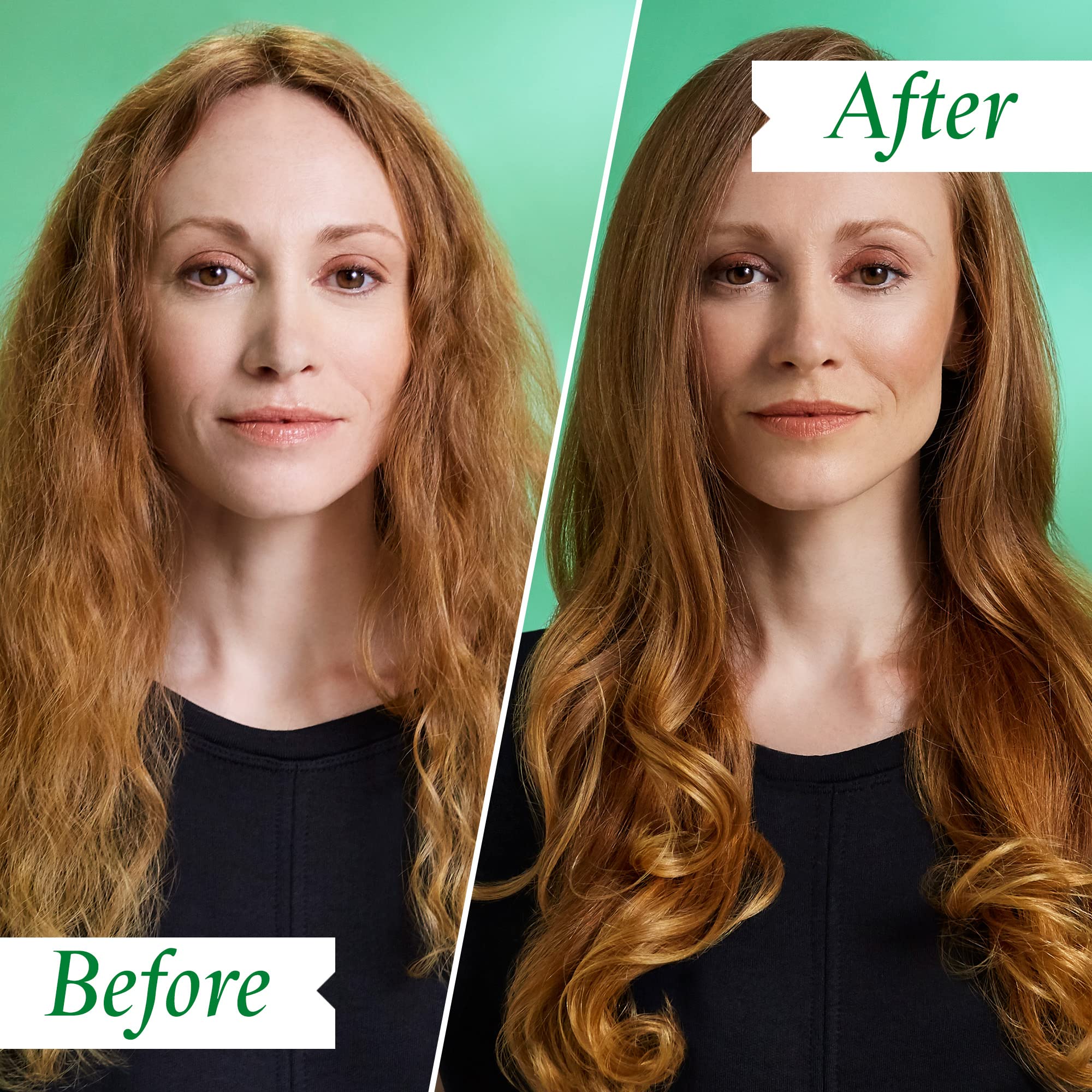 PHILIP KINGSLEY Flaky Scalp Shampoo for Dry, Oily Cleansing and Soothing Scalp Care - Soothes and Calms, 8.45 oz.