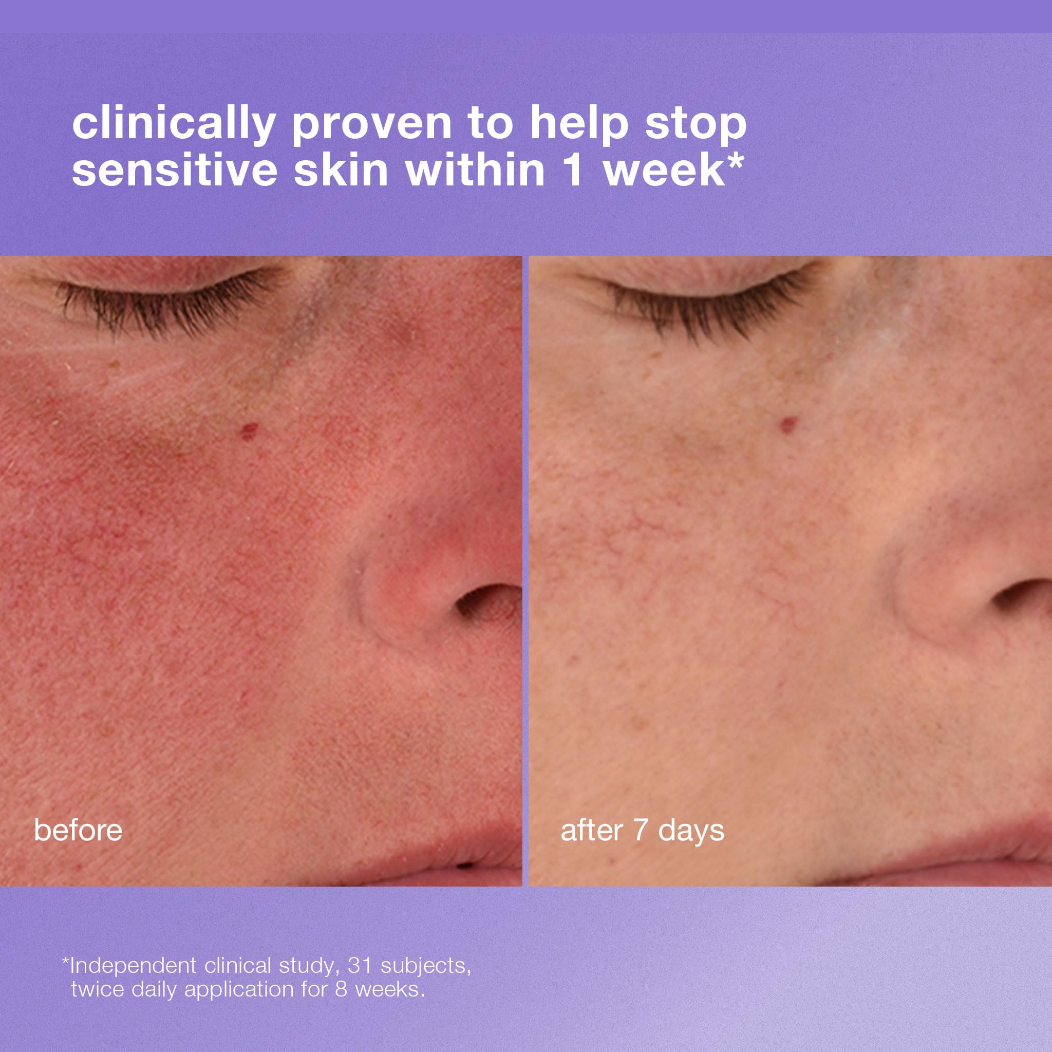 Dermalogica Stabilizing Repair Cream, Face Moisturizer for Sensitive Skin with Cica - Strengthens, Soothes, and Repairs Skin Barrier, 0.5 fl oz