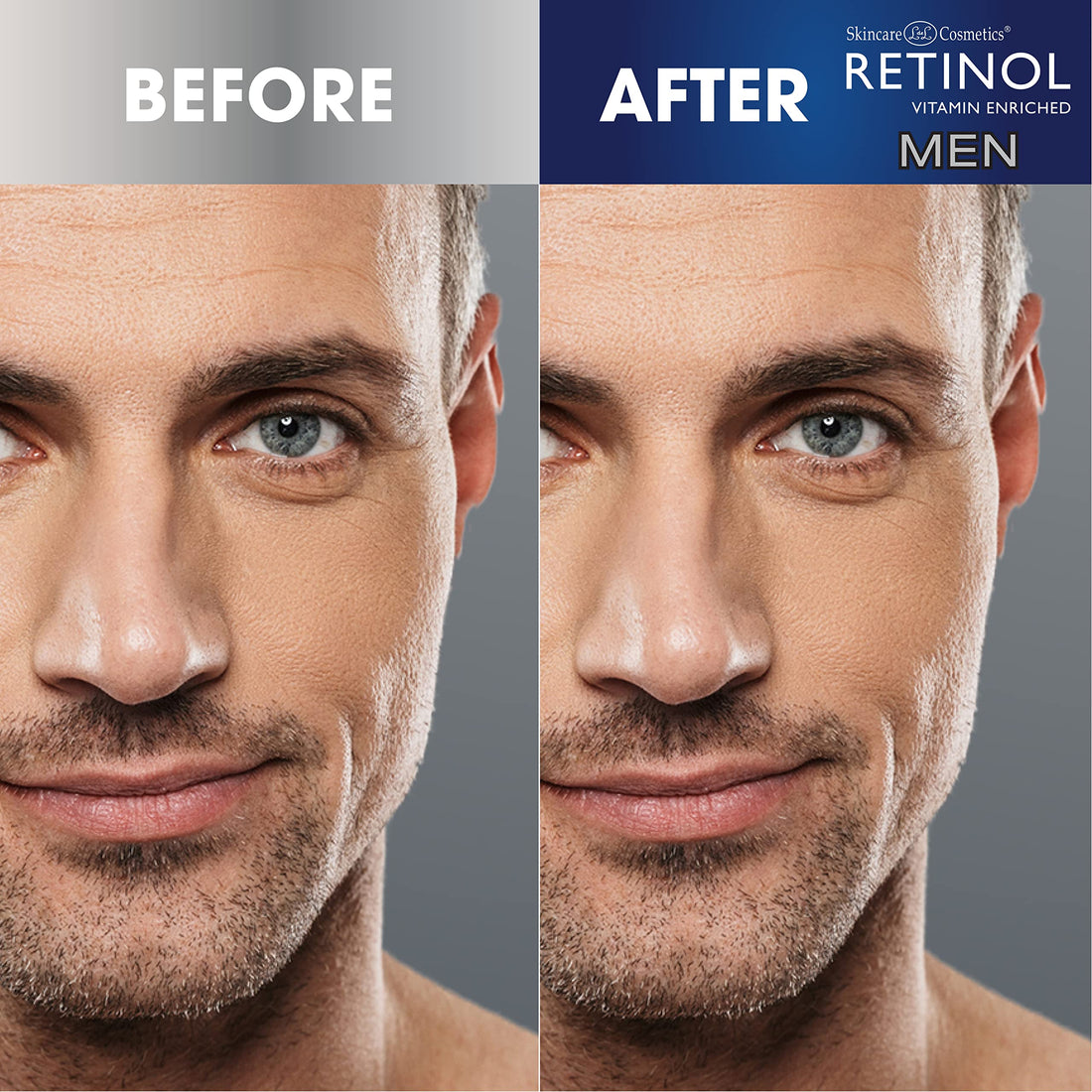 Retinol Eye Cream for Men, 0.5 Ounce